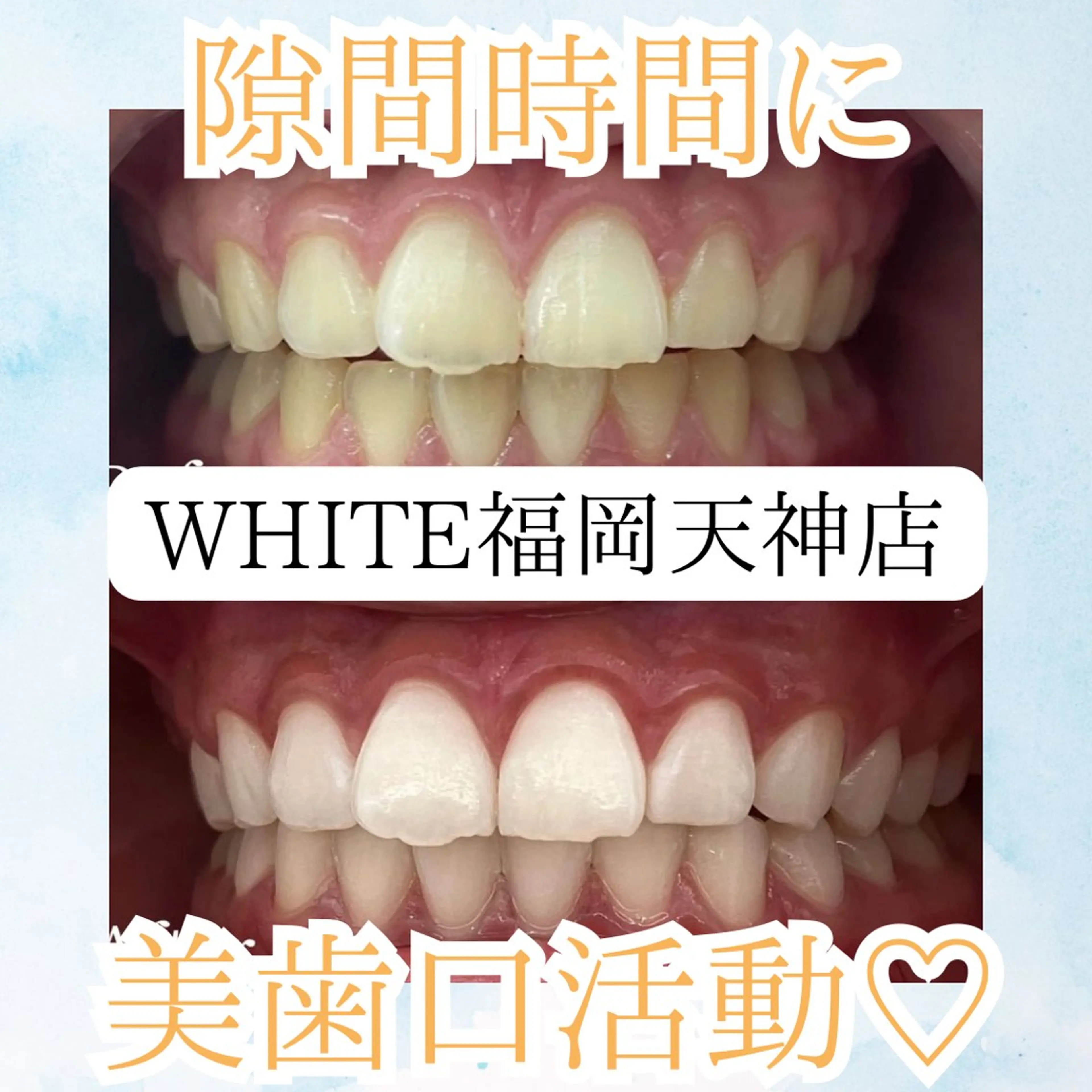 メンズ エステ リラク ホワイトニング専門店 WHITE天神店のエステ・リラクイメージ