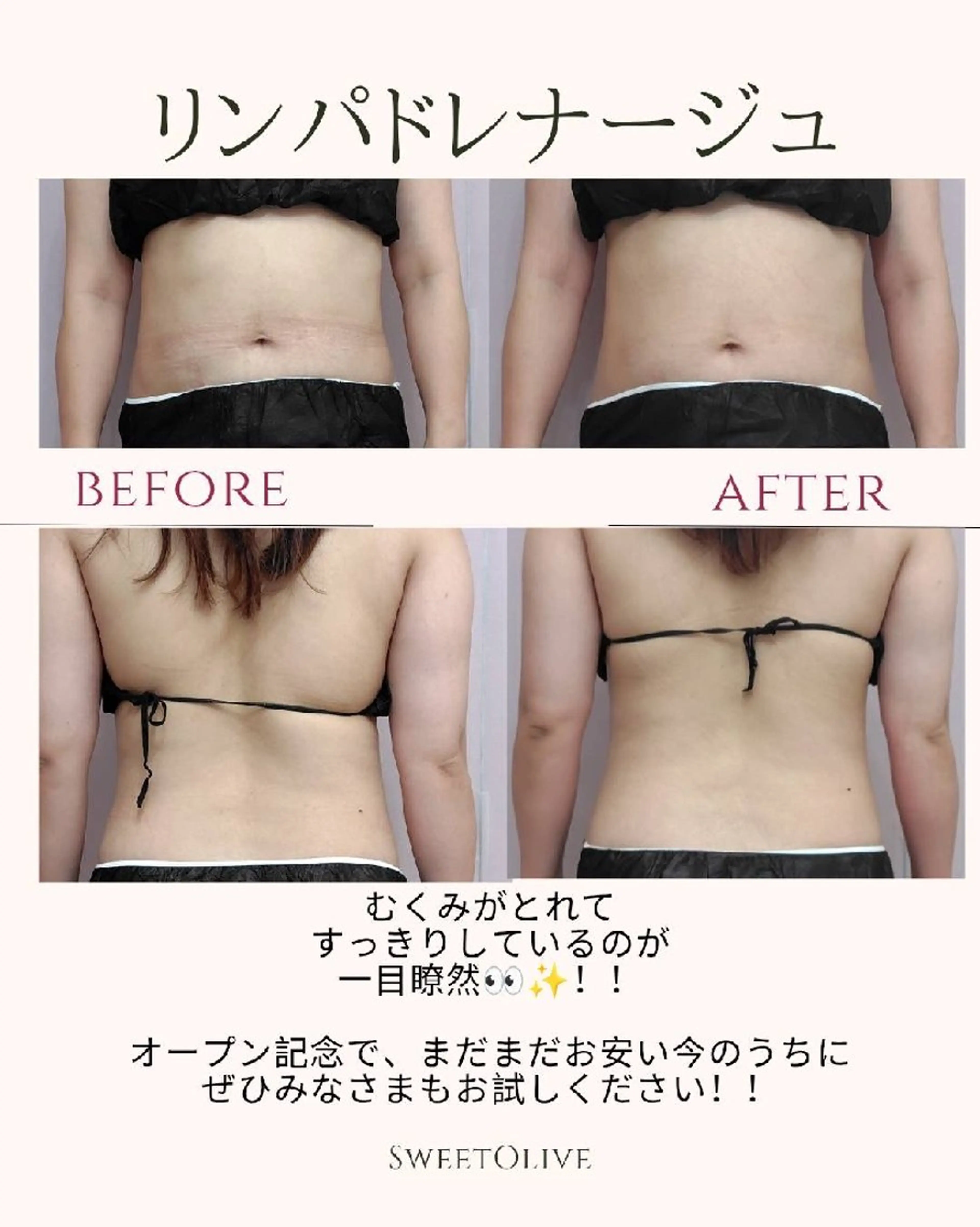 トータルビューティーサロンSweet Olive所属・SweetOlive  Akaneのエステ・リラクイメージ