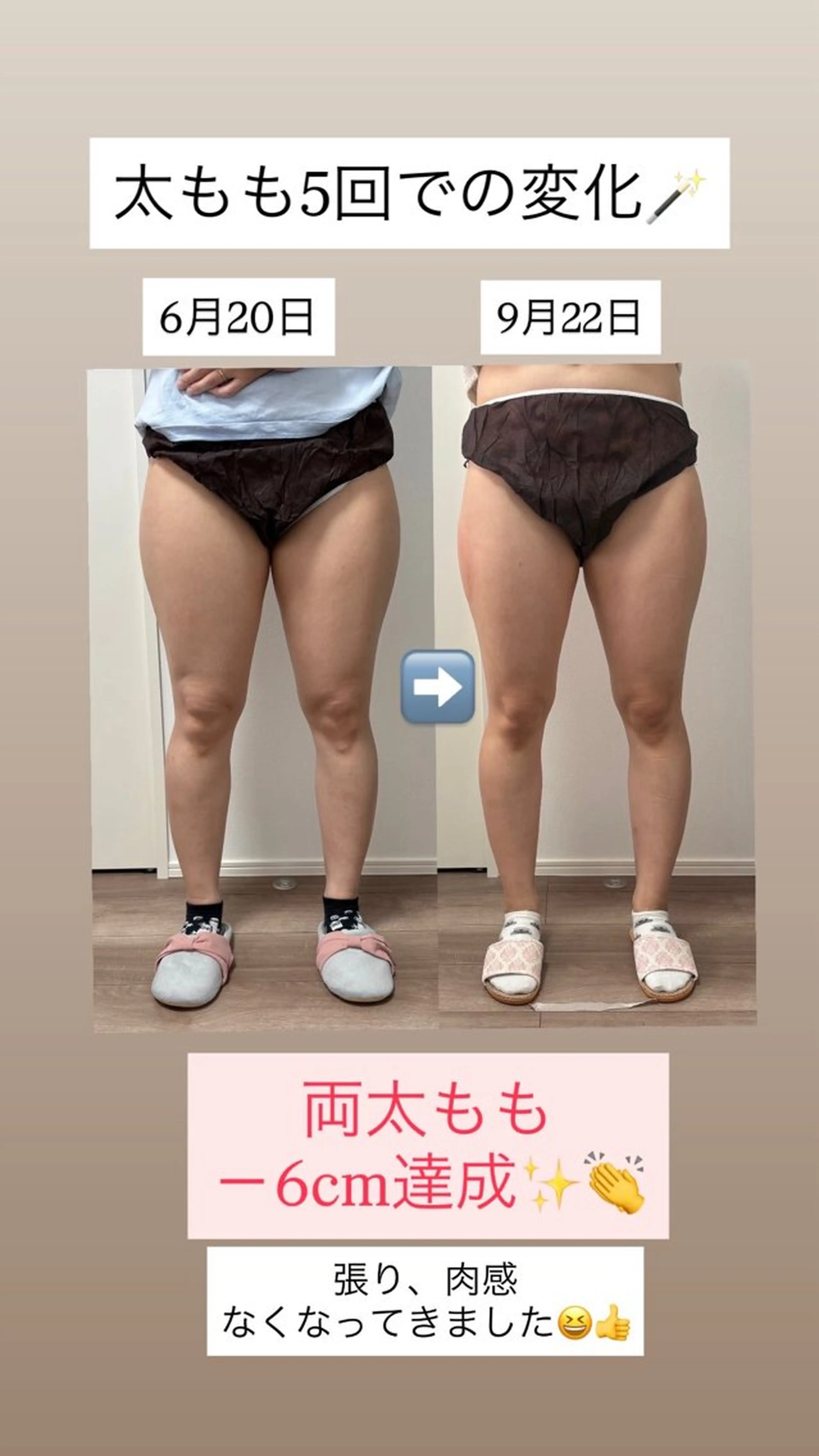 Miiju.所属・Miiju. 石巻市 脂肪冷却  鈴木のエステ・リラクイメージ