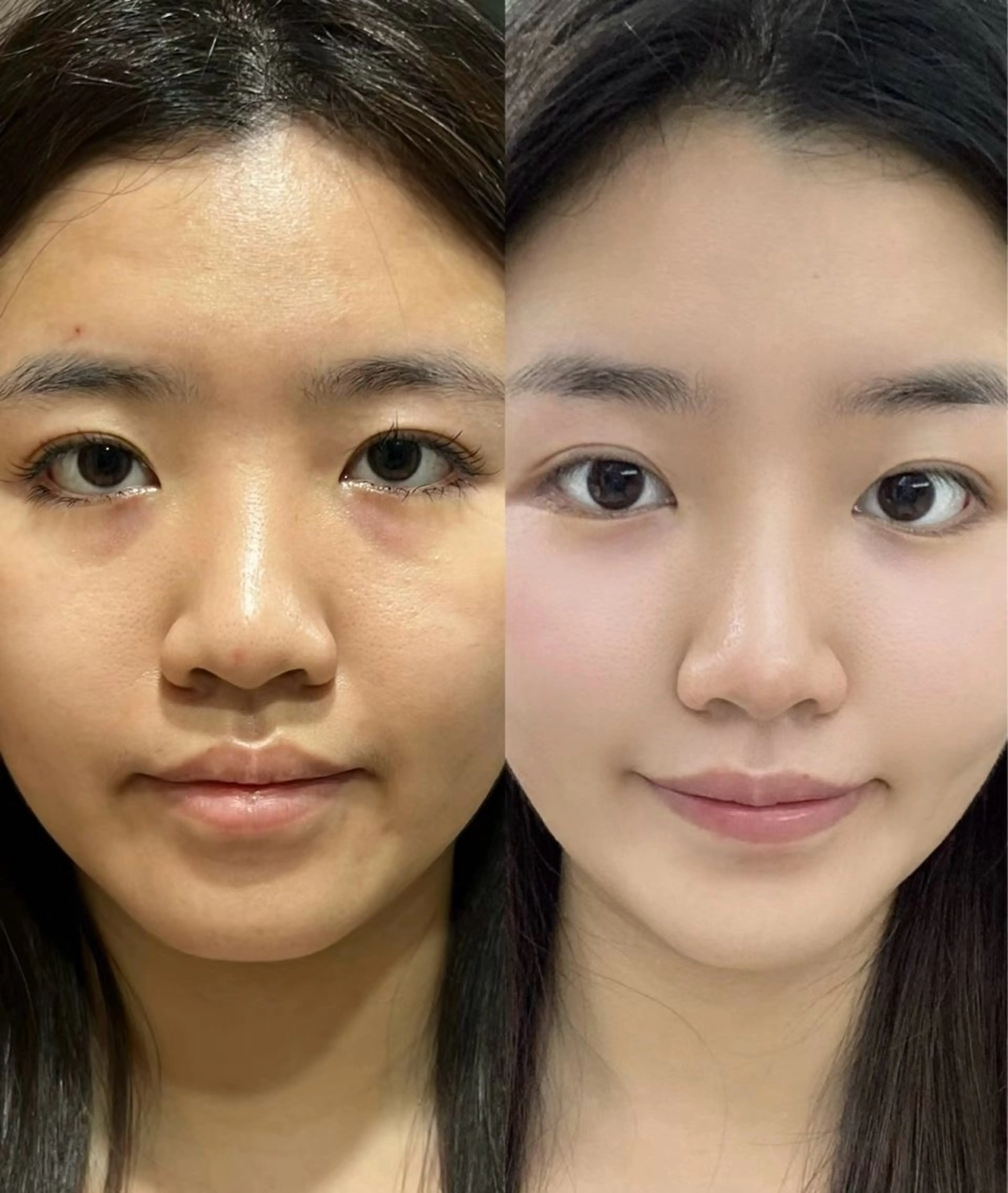 マツエク・マツパ エステ aliaハイフ&水光ジェットサロン所属・aliaハーブ水光店 エステティシャン募集のエステ・リラクイメージ