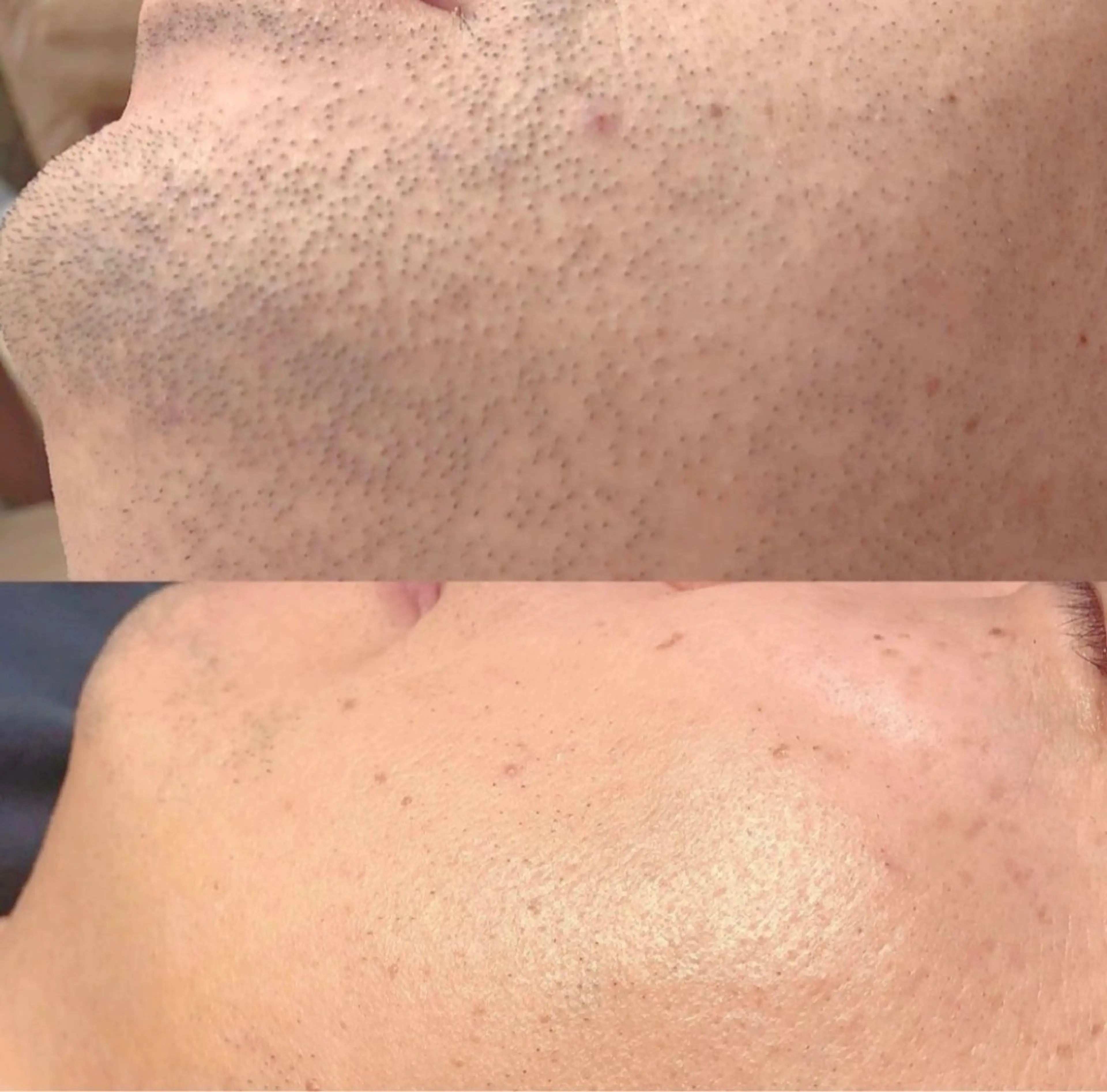 yokohama 🎀miaのマツエク・マツパデザイン