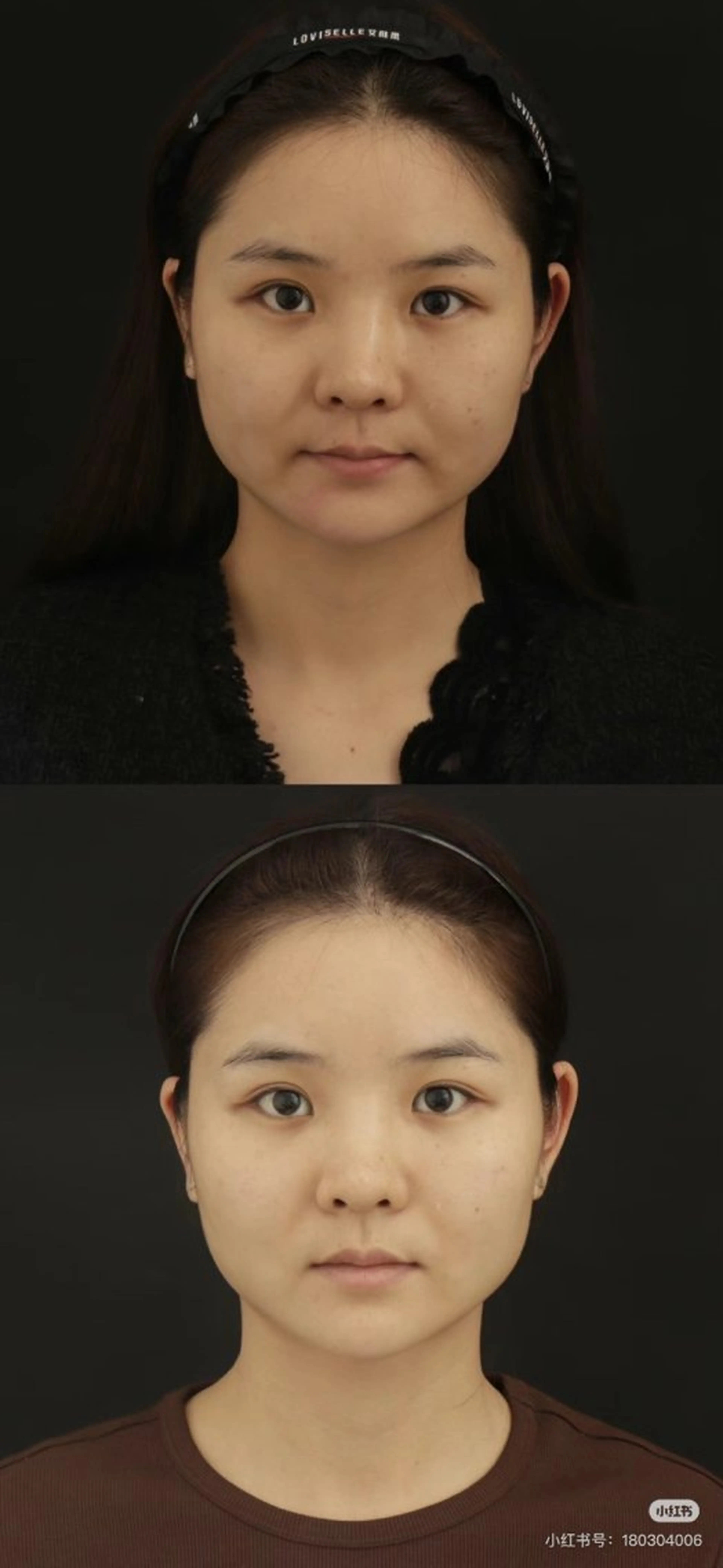 マツエク・マツパ 韓国風マツエク エステ aliaハイフ&水光ジェットサロン所属・aliaハーブ水光店 エステティシャン募集のエステ・リラクイメージ