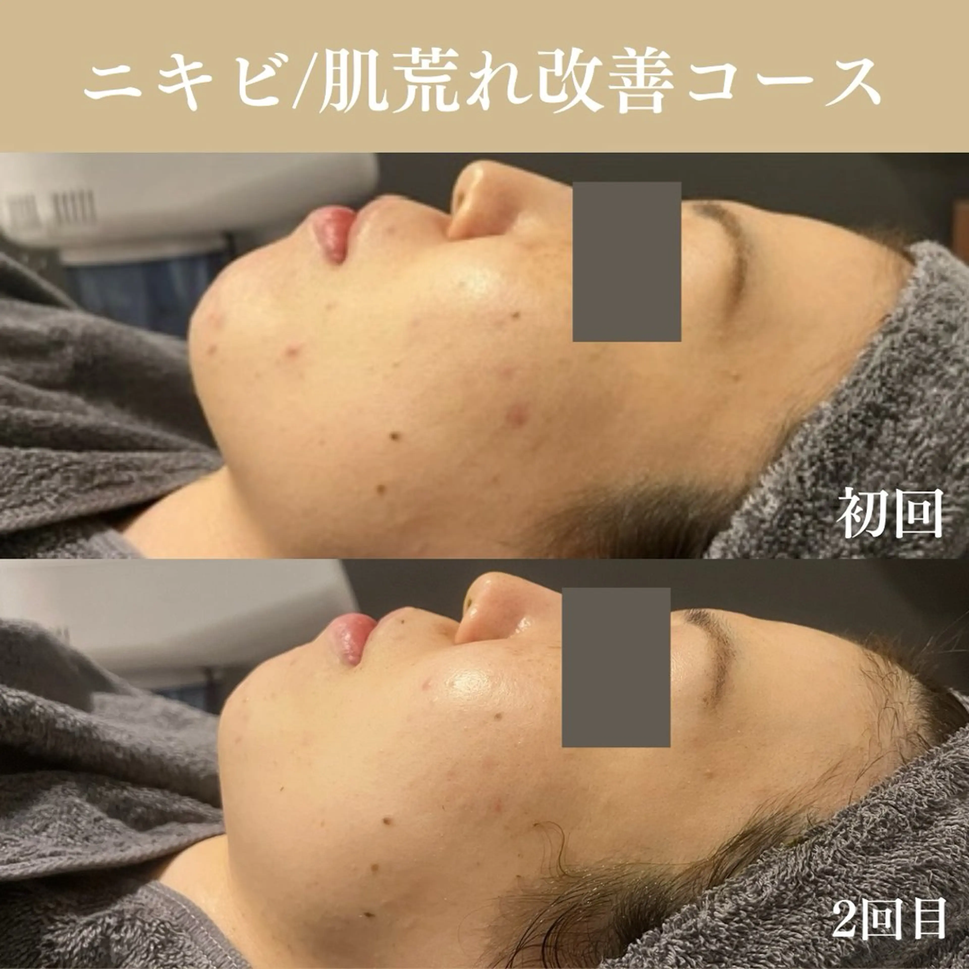 Oncebell. Bodymake&beautysalon所属・Oncebell. ワンベルのエステ・リラクイメージ