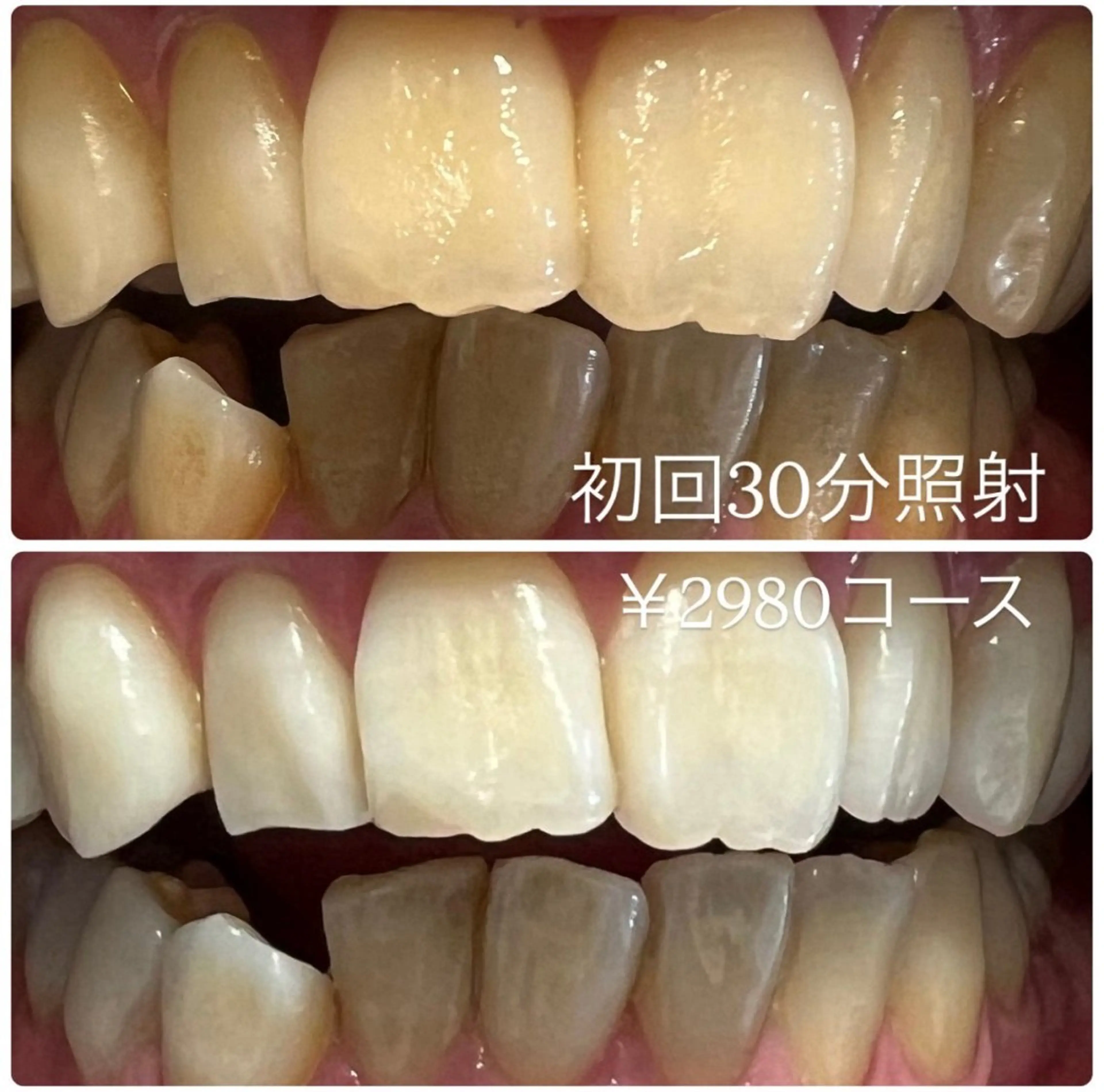 その他 PLATINUM Beauty 横浜店所属・ホワイトニングルーム 横浜店のその他イメージ