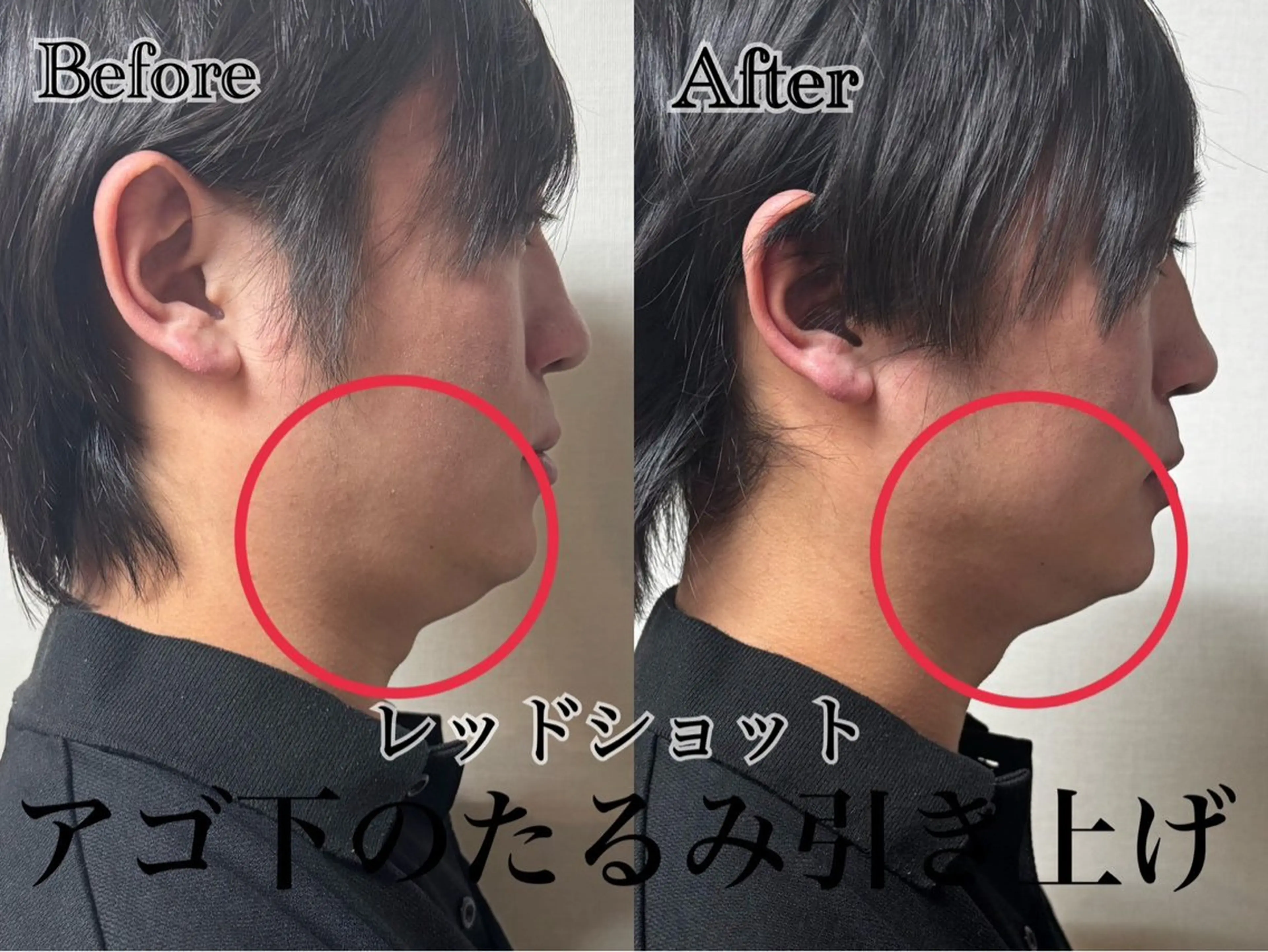 六本木脱毛andS さおりのエステ・リラクイメージ