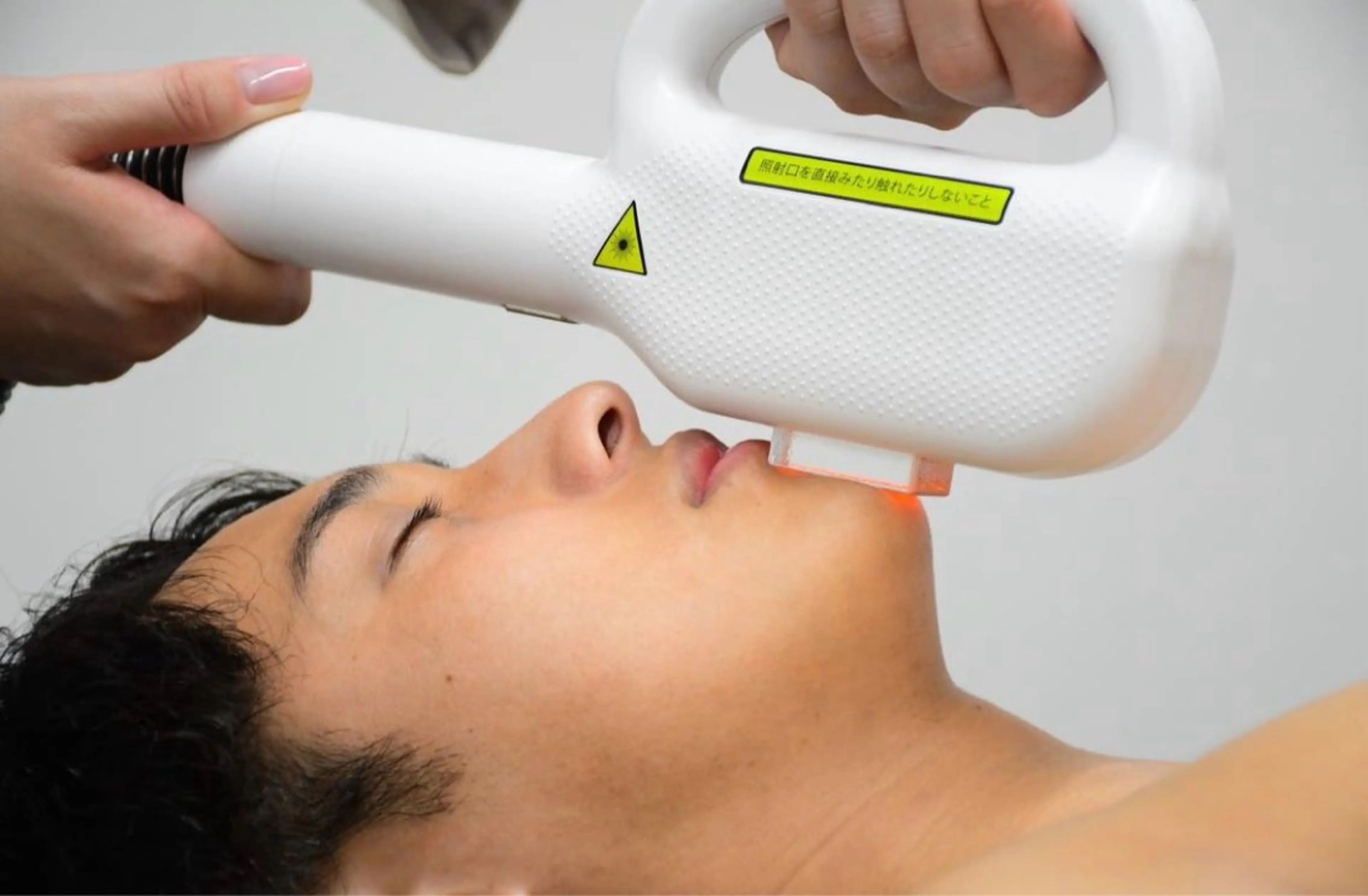 【男性】ヒゲセット【額/ほほ/鼻下/あご/もみあげ】※施術相談ありの写真