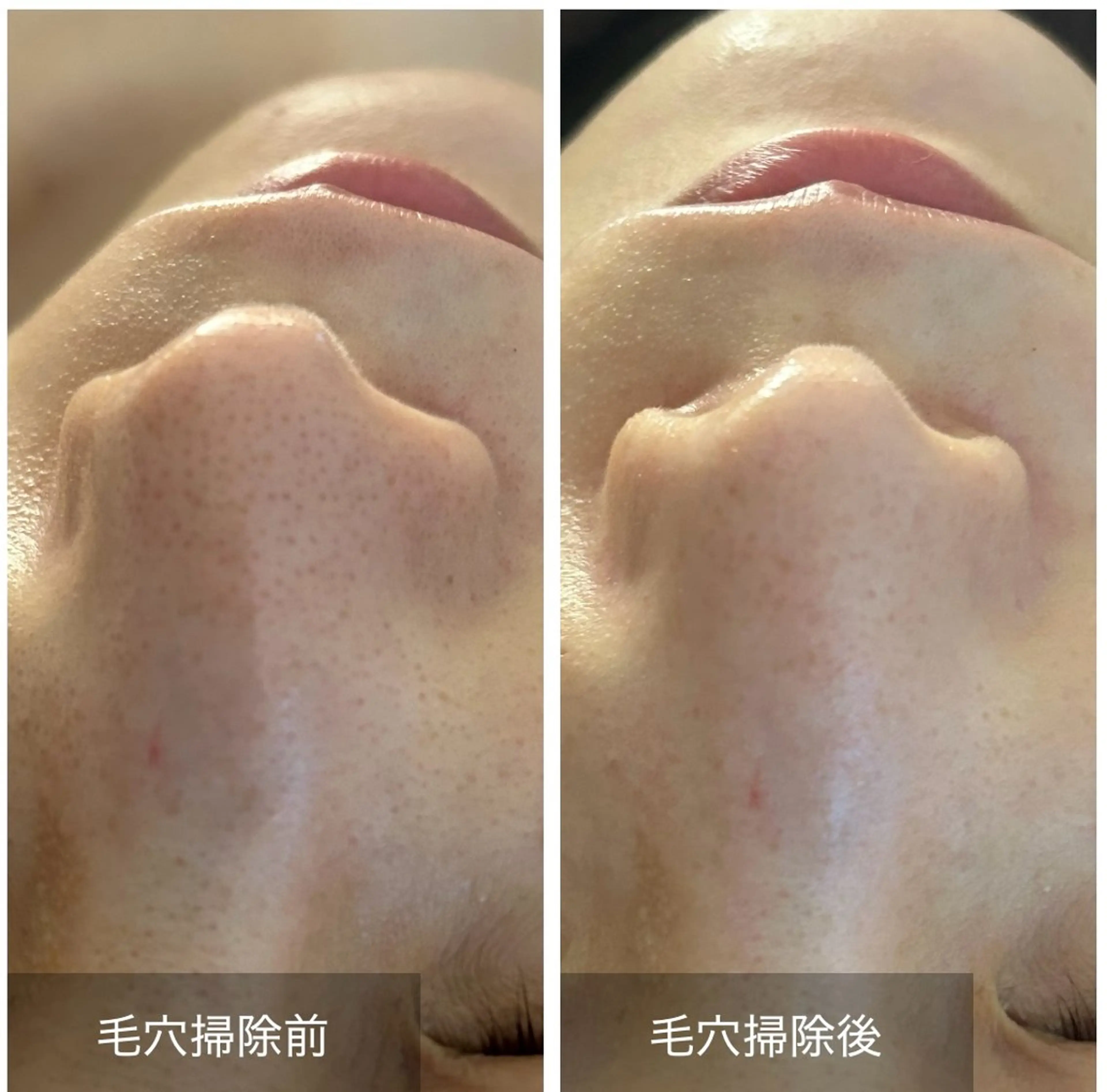 エステ 🌿 NATSUMI🌿のエステ・リラクイメージ