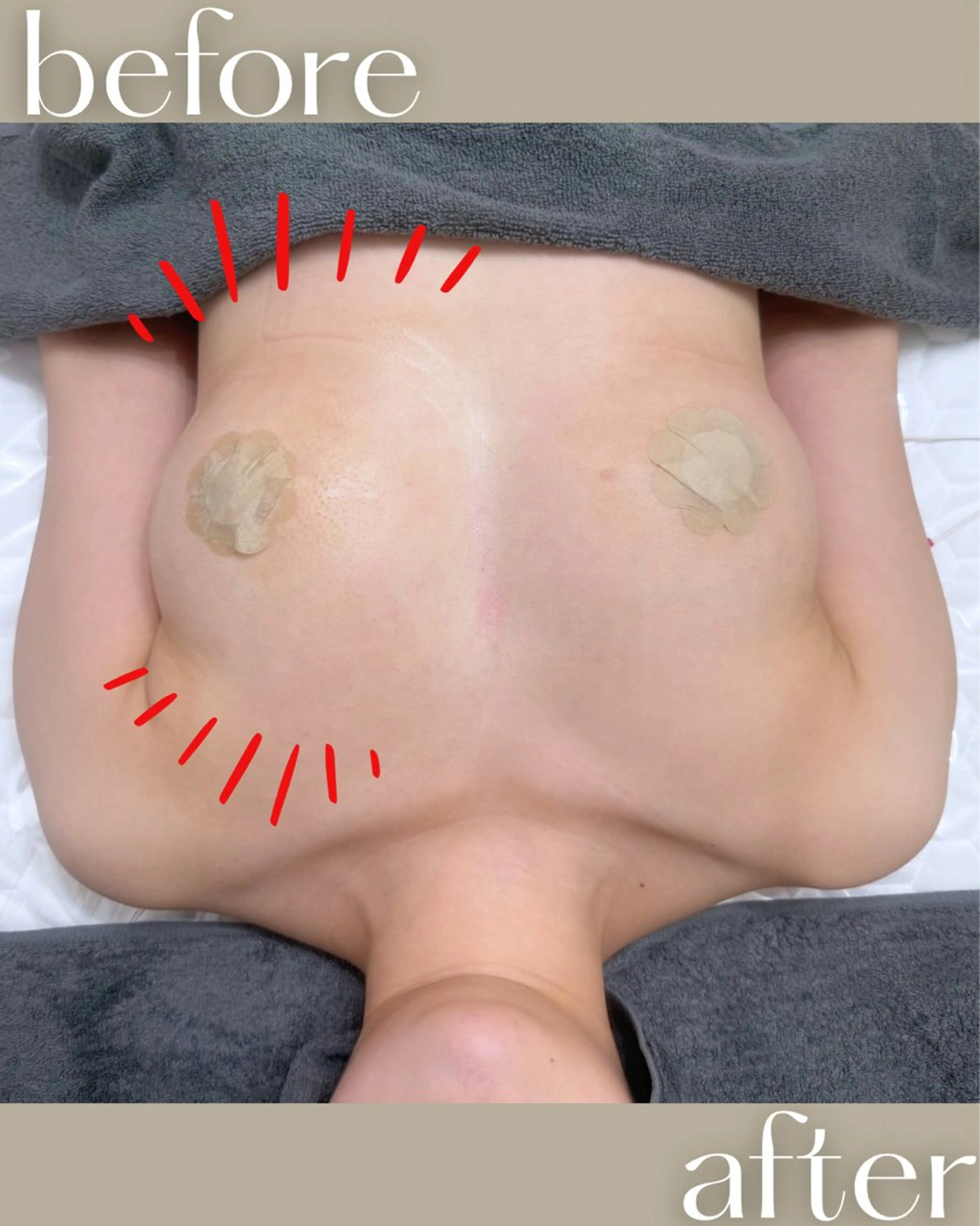 バストケア専門店| canyのエステ・リラクイメージ