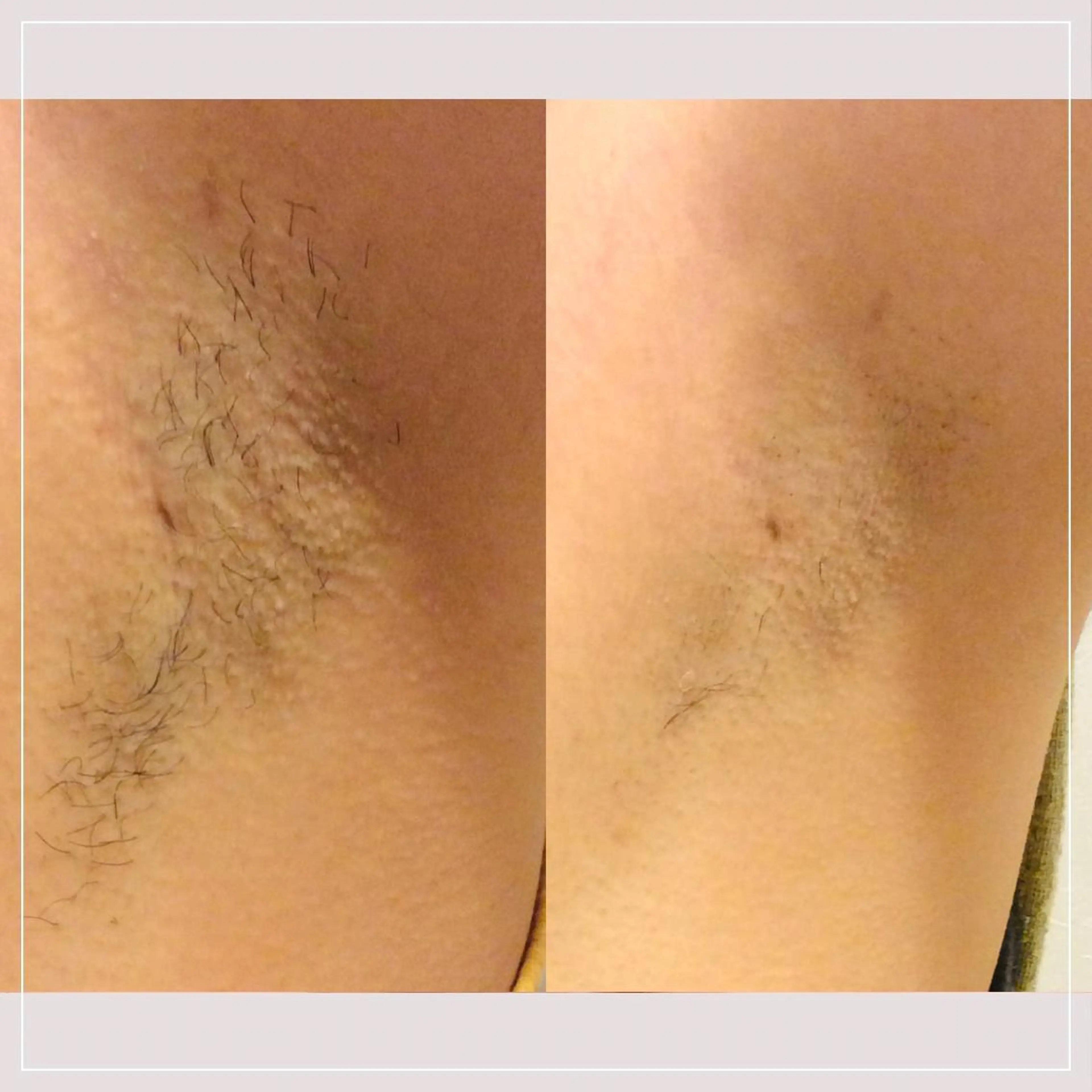 RICCO 堺東所属・RICCO 堺の眉毛・アイブロウイメージ