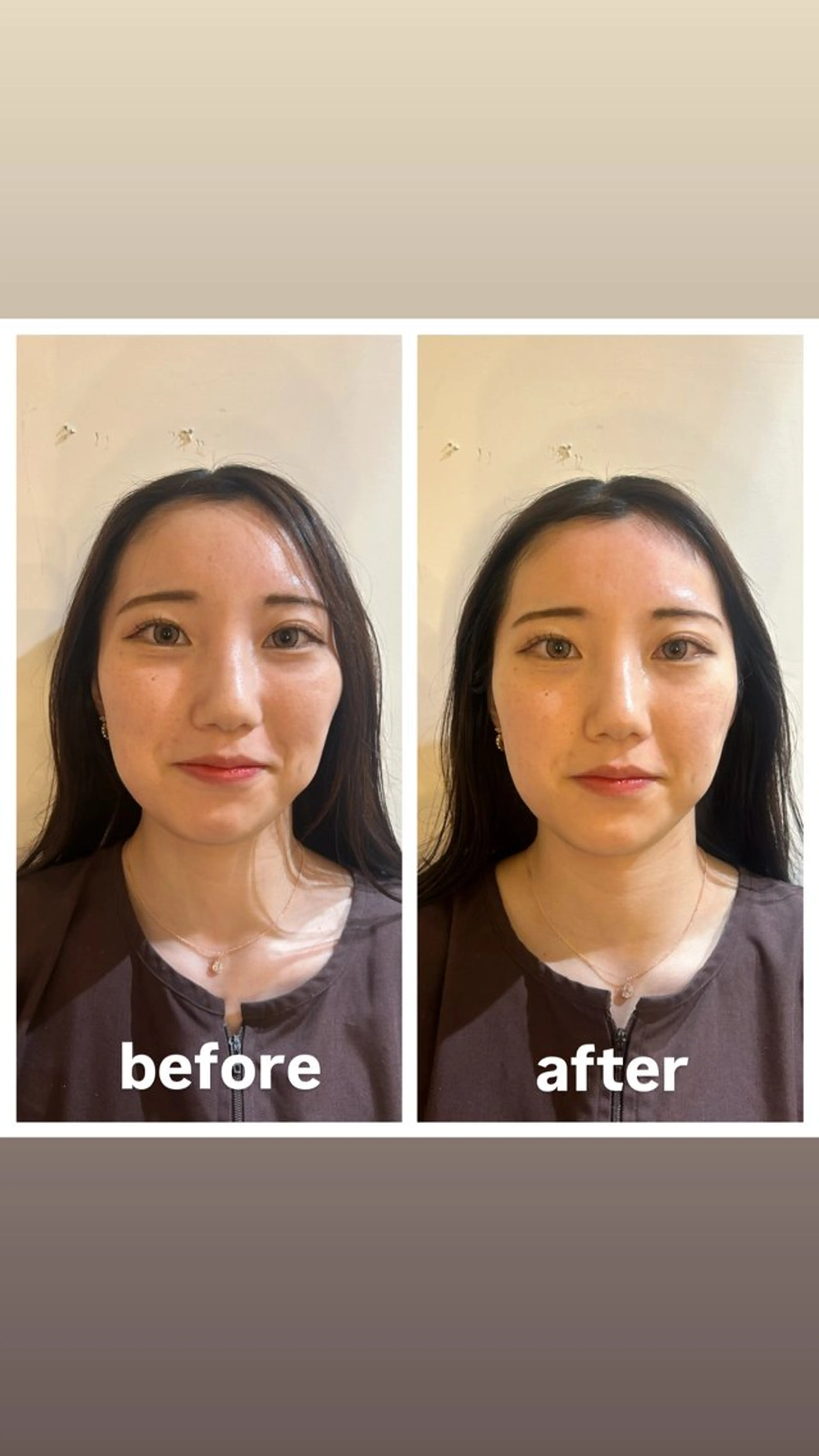 エステ リラク 美容鍼灸女性専用 りんご鍼灸治療院のエステ・リラクイメージ