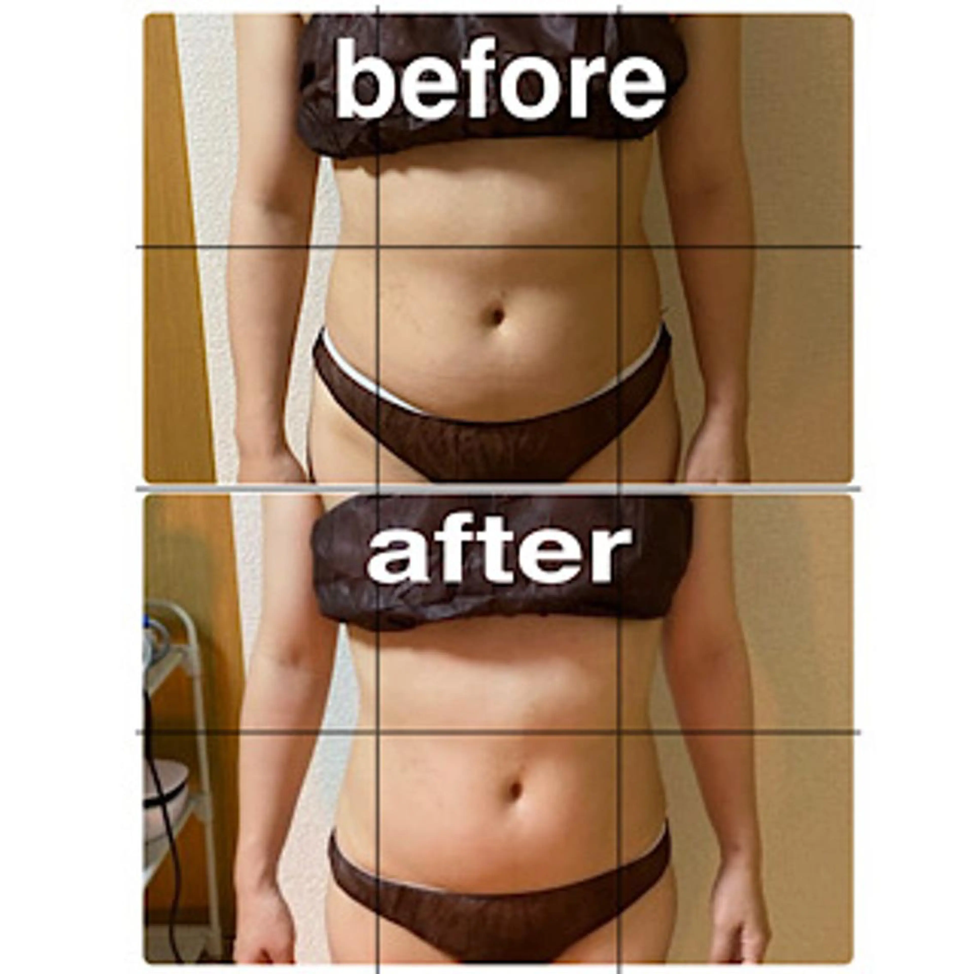 【120分】お試し痩身メニュー、まずは1度試してみませんか？気になる部位を集中的に施術させていただきます。の写真