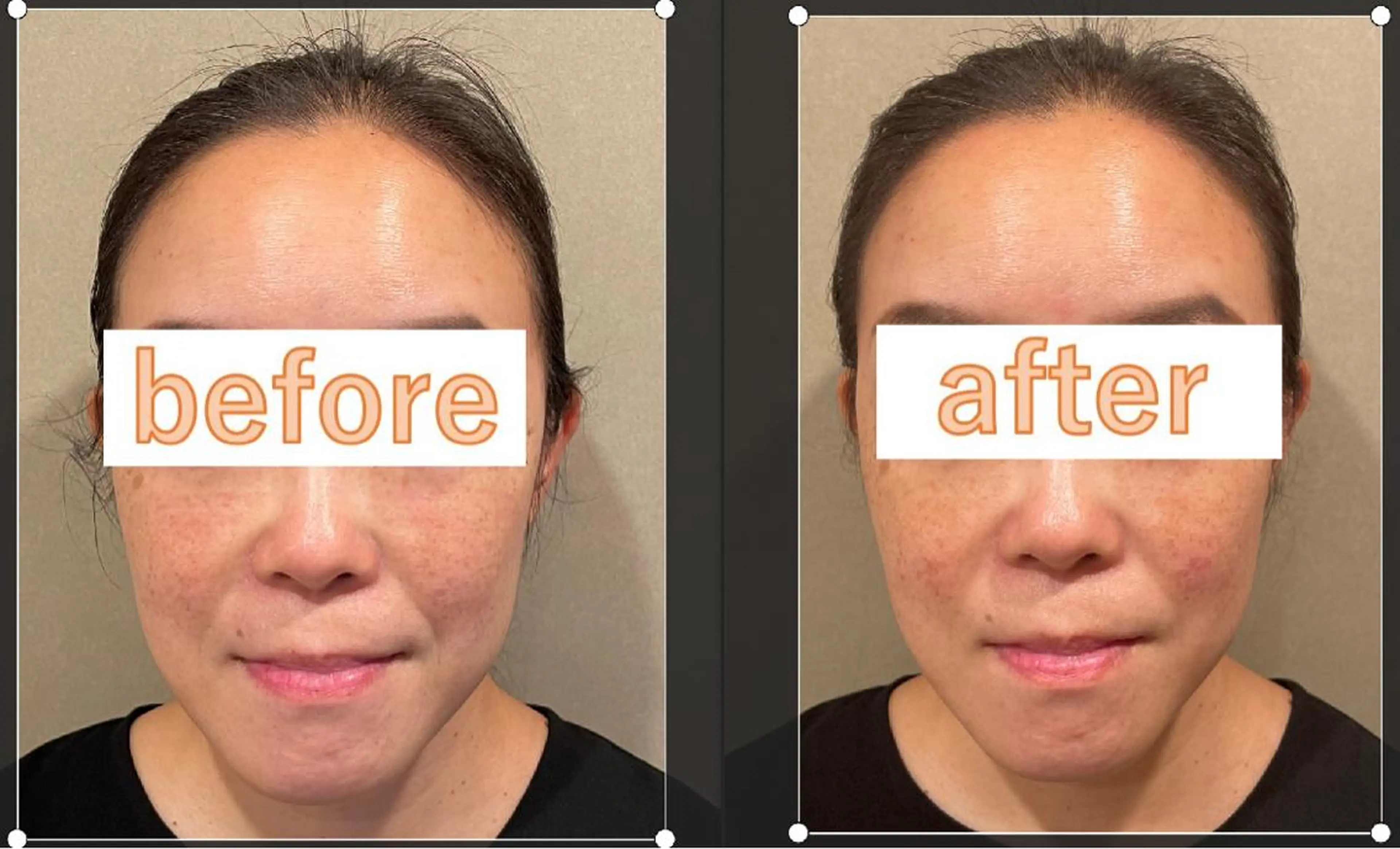 美容鍼灸サロン      APLUS所属・美容鍼灸サロン APLUSのエステ・リラクイメージ