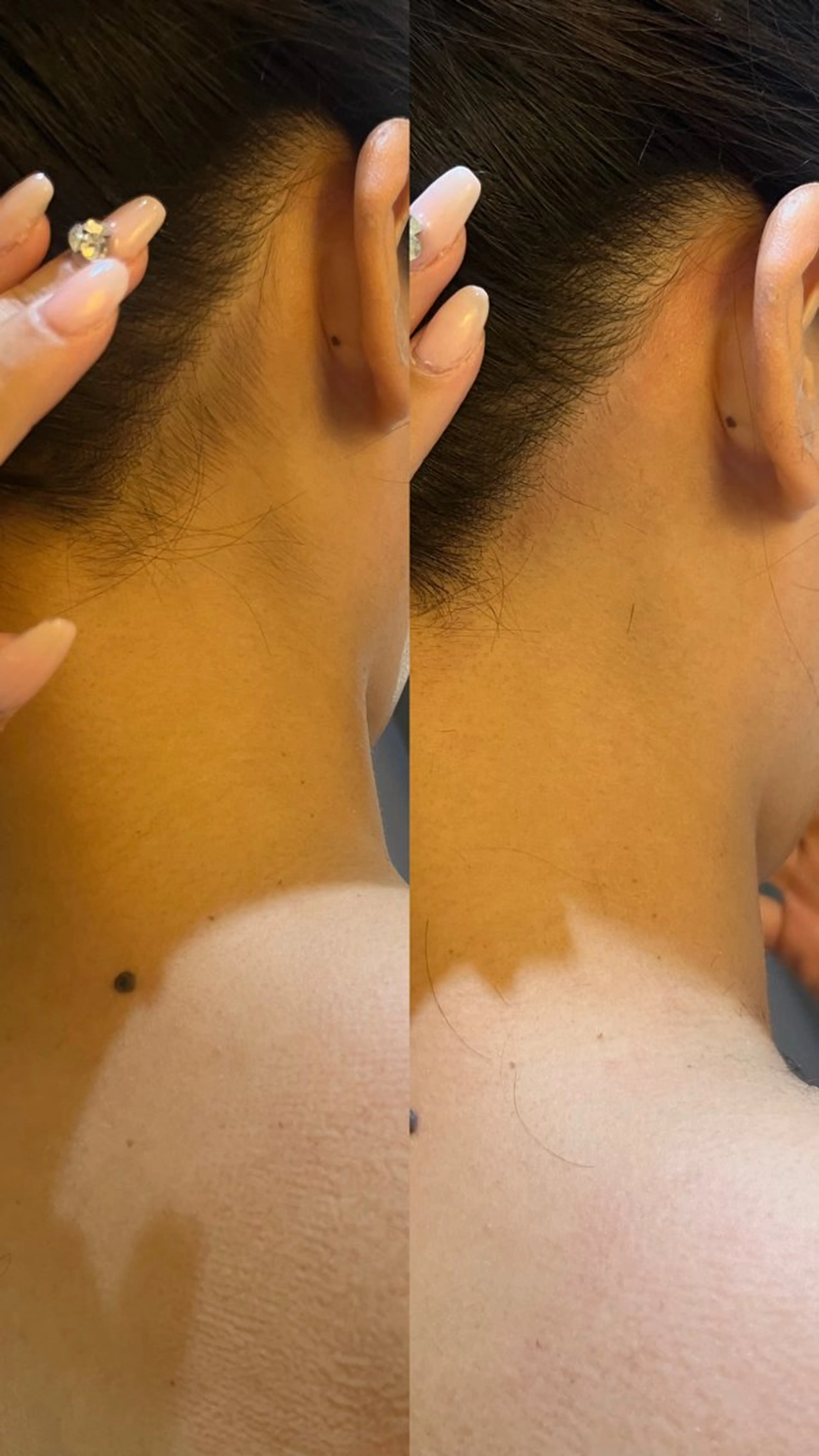 脱毛 うなじ脱毛/美肌脱毛 LABELのエステ・リラクイメージ