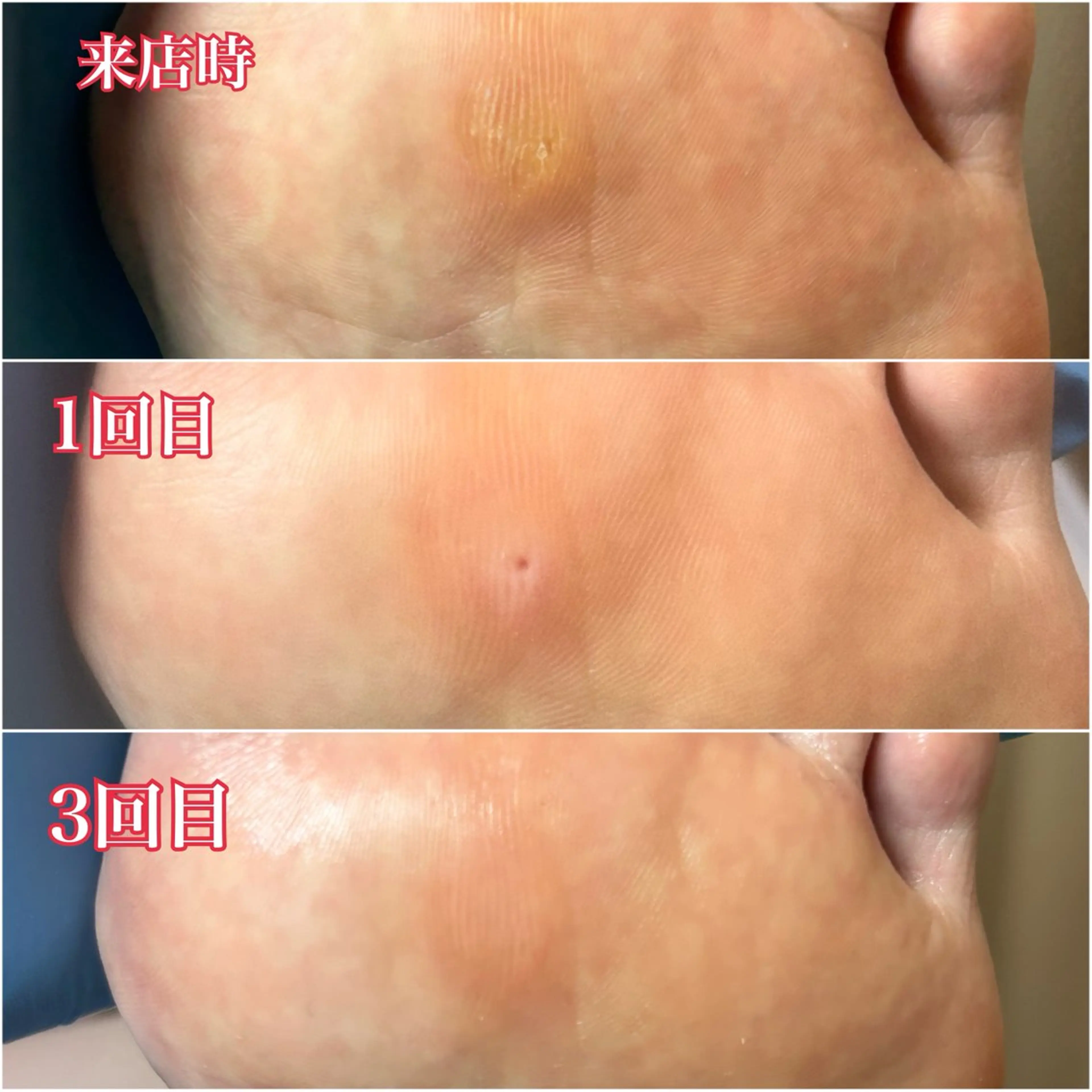 巻き爪補正店　柏店所属・巻き爪補正店 柏店のその他イメージ