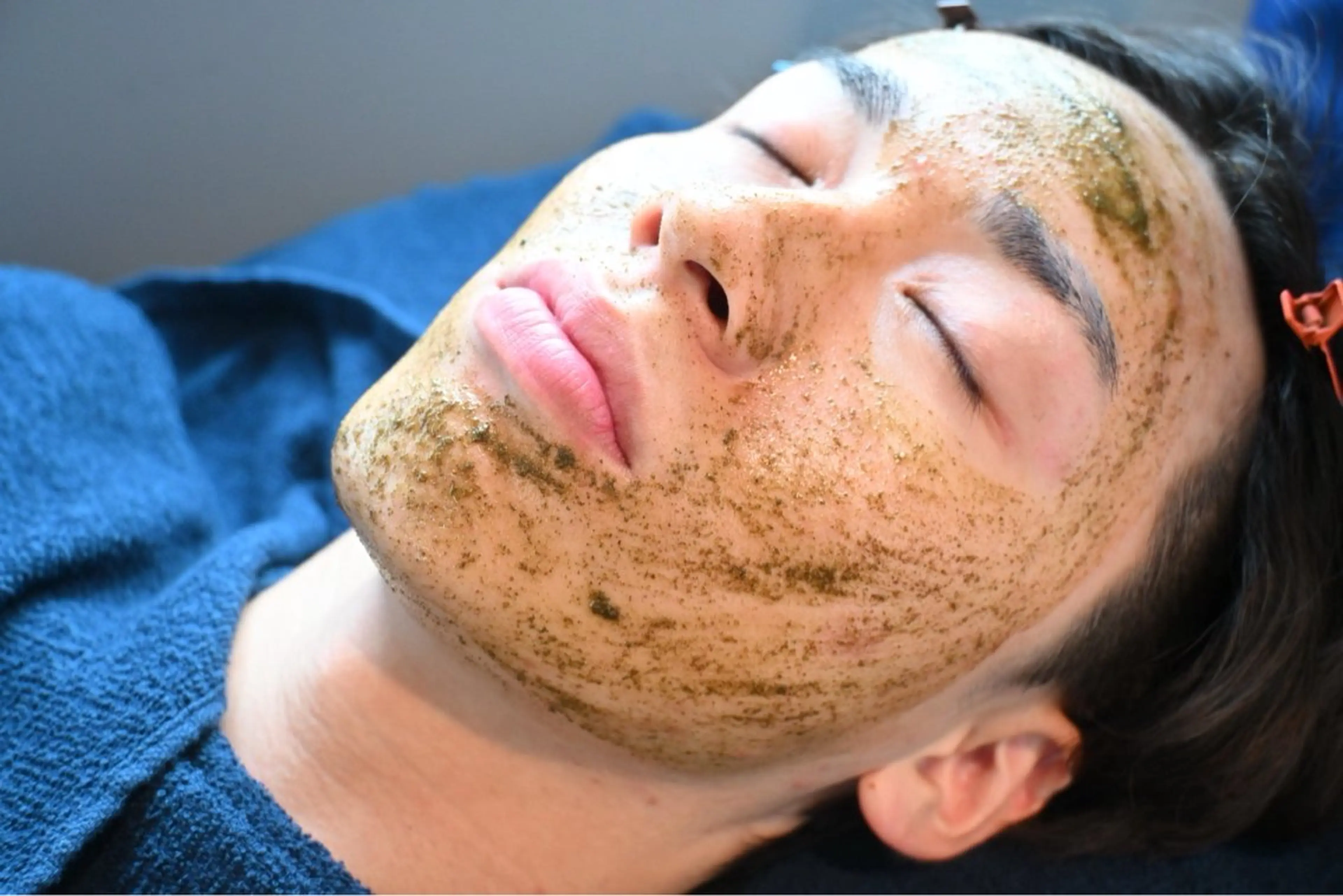 ハーブピーリング、鎮静パック、マグニート(痩身機器)※ご希望の場合のみの写真