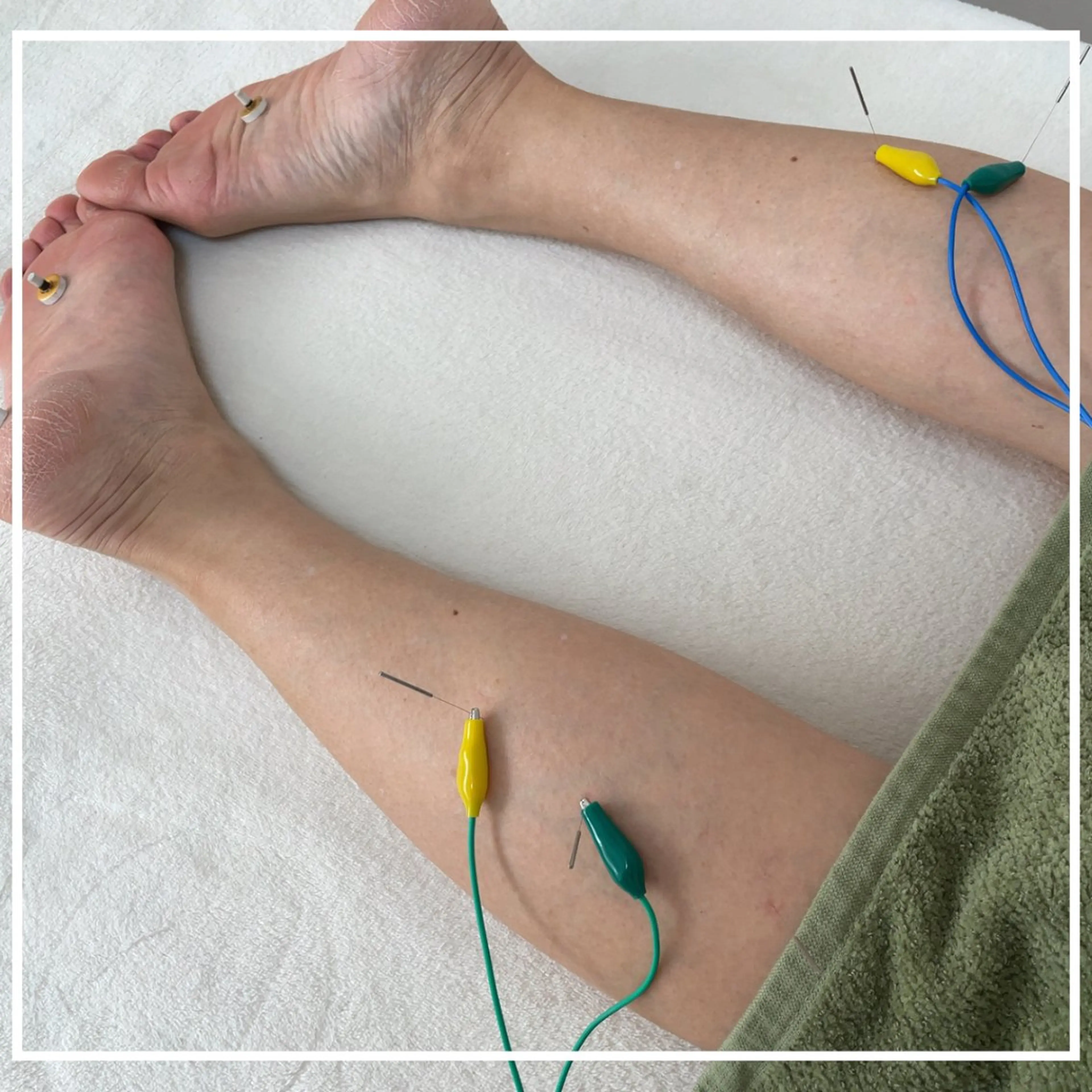 美容鍼灸サロン   colorier所属・美容鍼灸サロン colorierのエステ・リラクイメージ