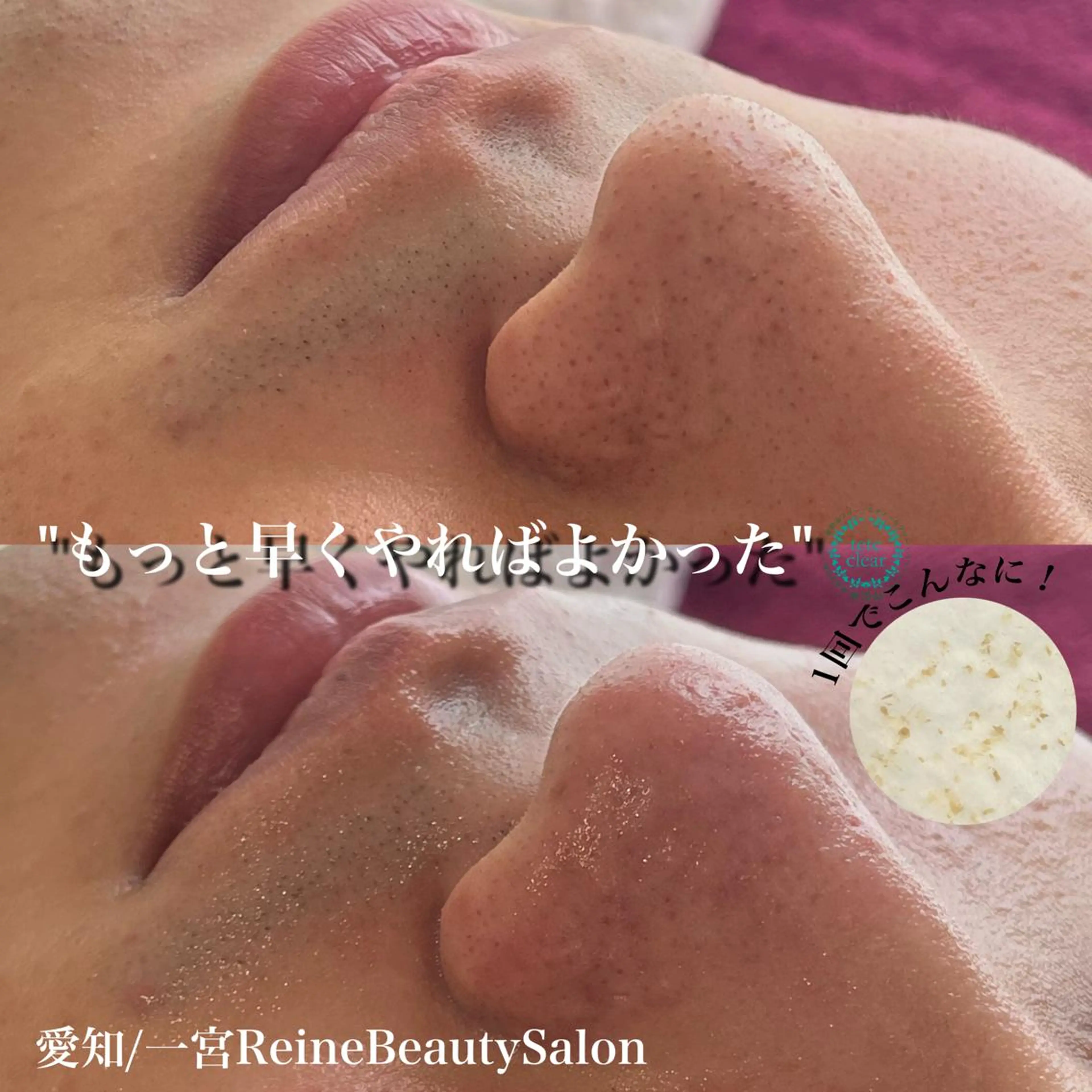 エステ Reine BeautySalon所属・毛穴/シミ肝斑/脱毛 横山梨里のエステ・リラクイメージ