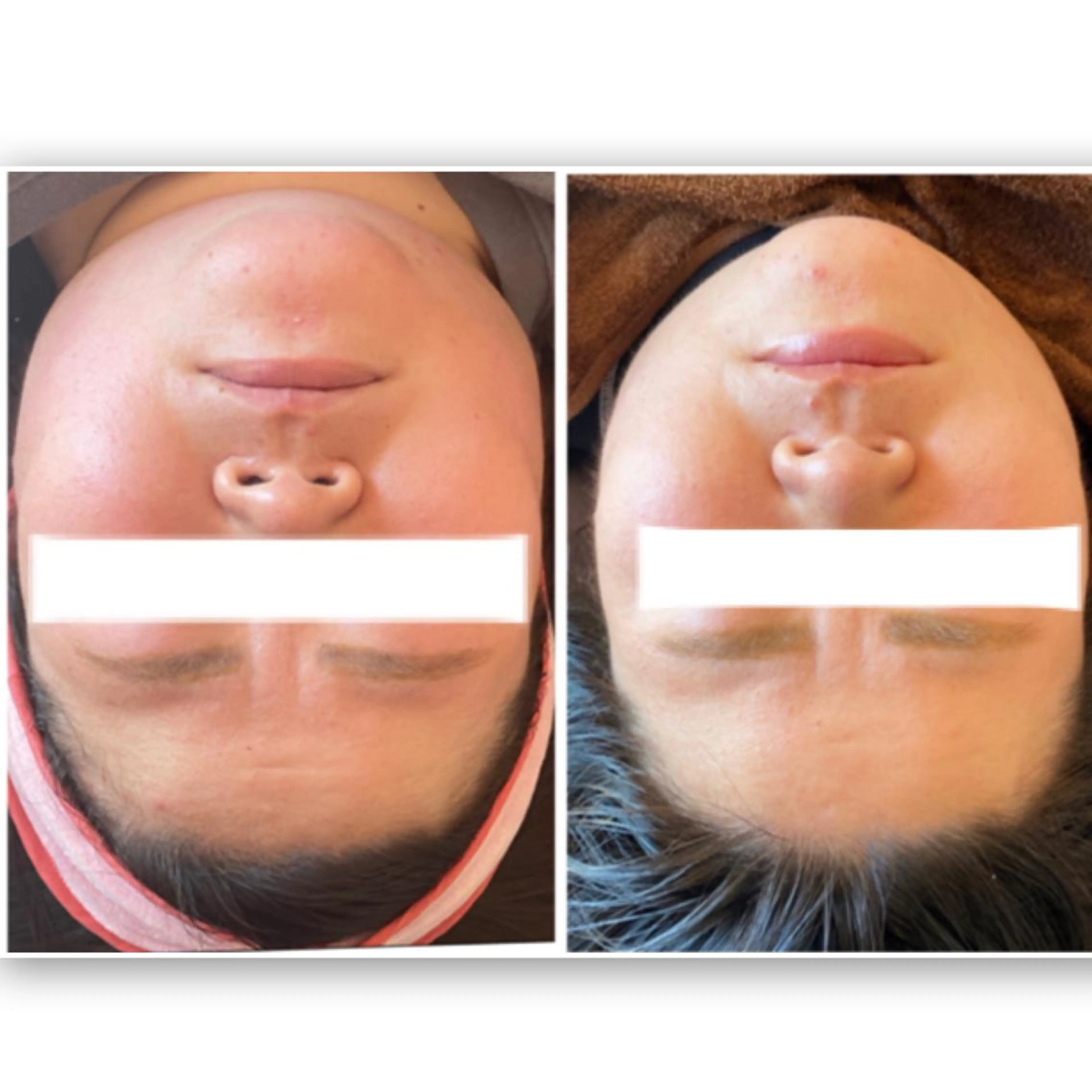 FLEUR大阪・美容 整体・痩身・小顔のエステ・リラクイメージ