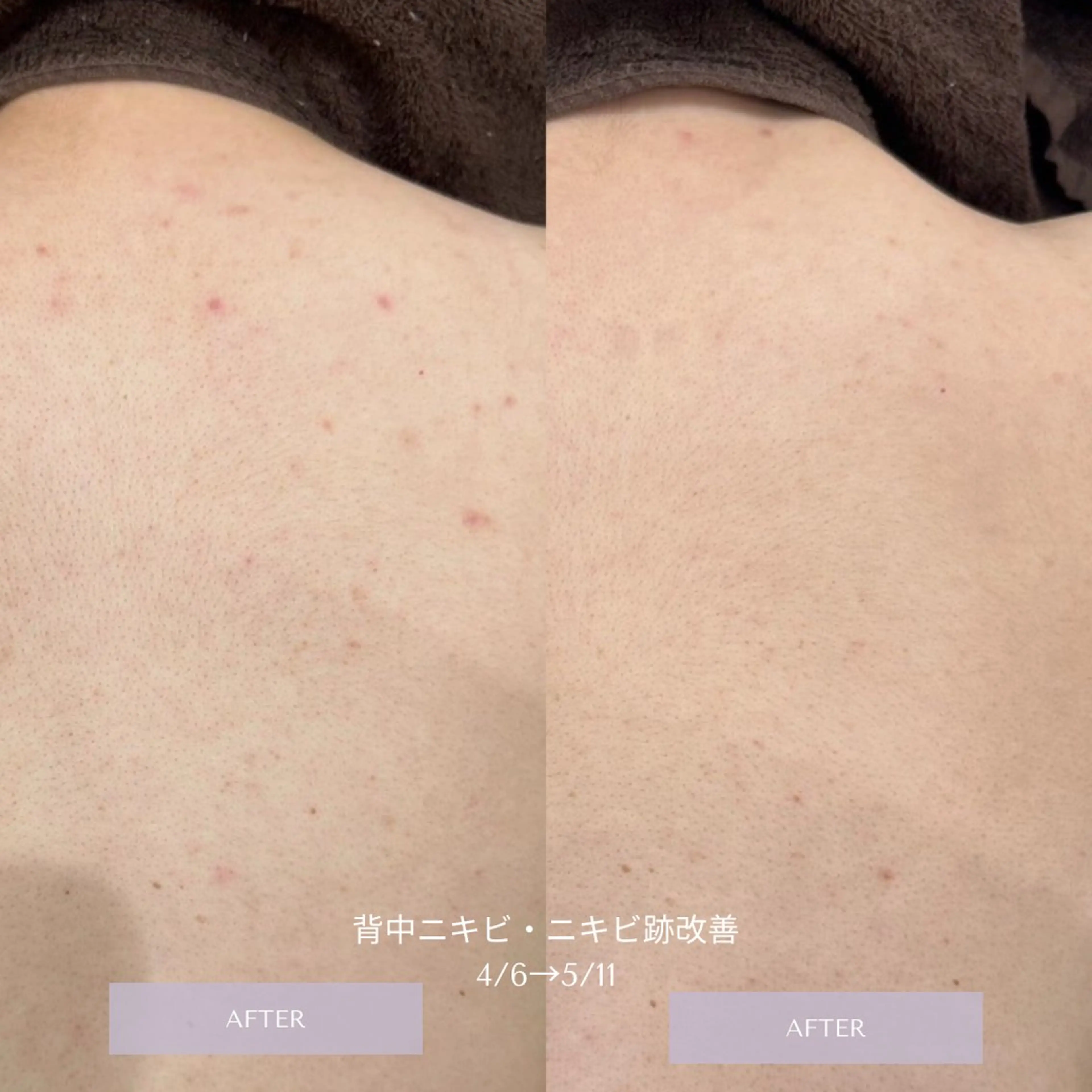 エステサロンTug高知駅前店所属・Tug 高知駅前店/ NANAMIのエステ・リラクイメージ