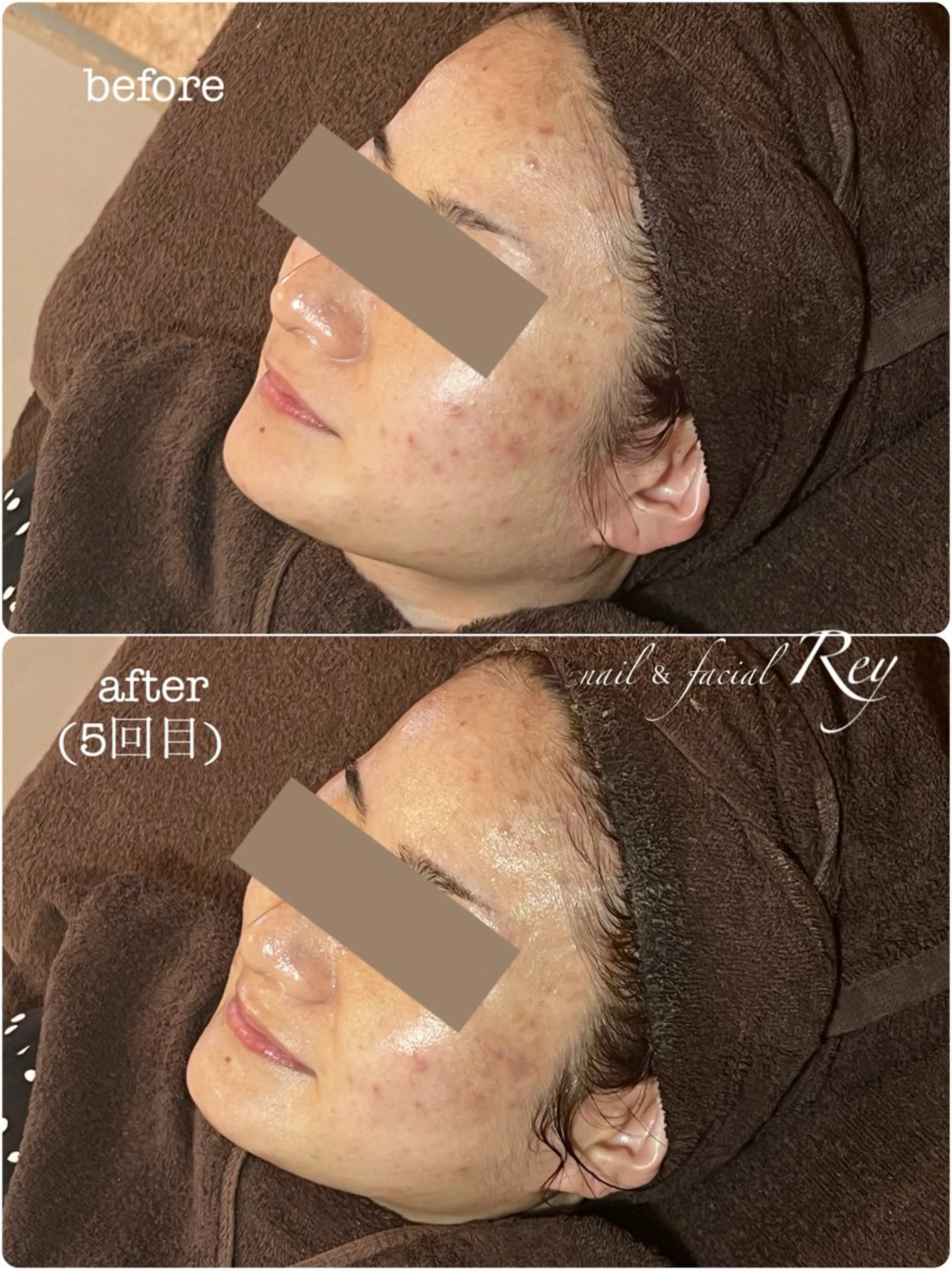 エステ R eyのネイルデザイン