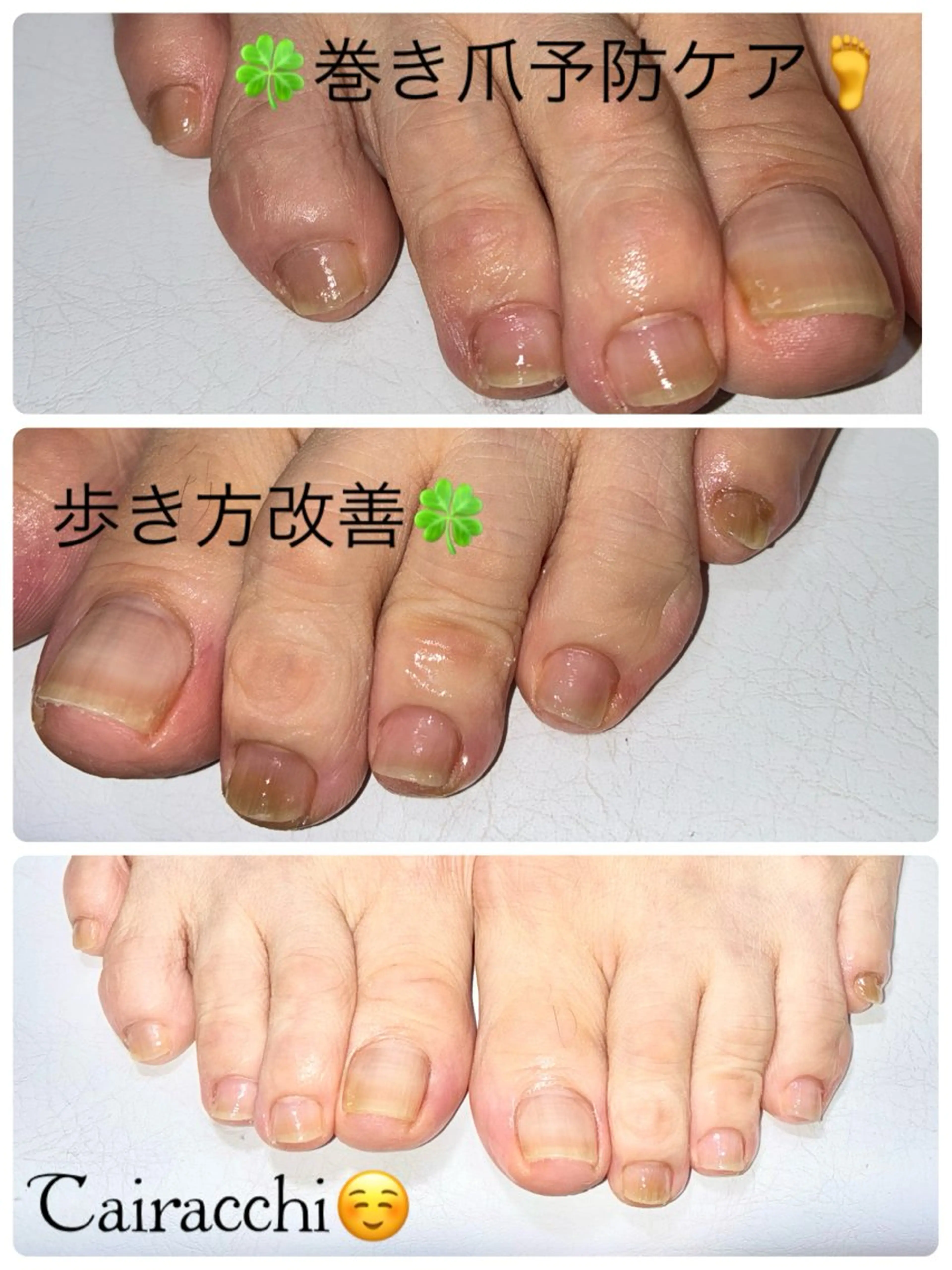 ネイル フットネイル フットネイル Tairacchi ﾀｲﾗｯﾁのエステ・リラクイメージ