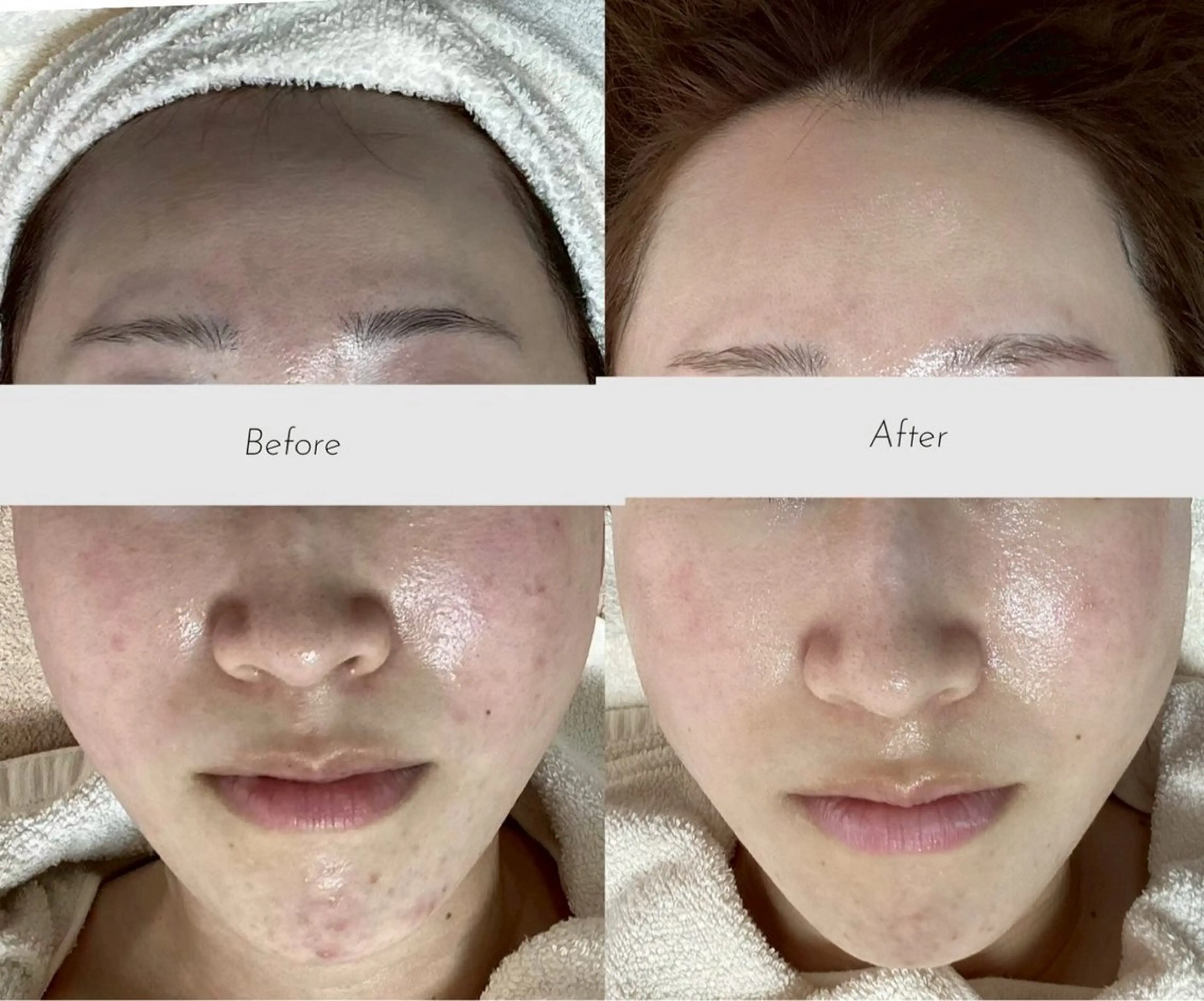 都度払い 肌質改善専門サロンのエステ・リラクイメージ