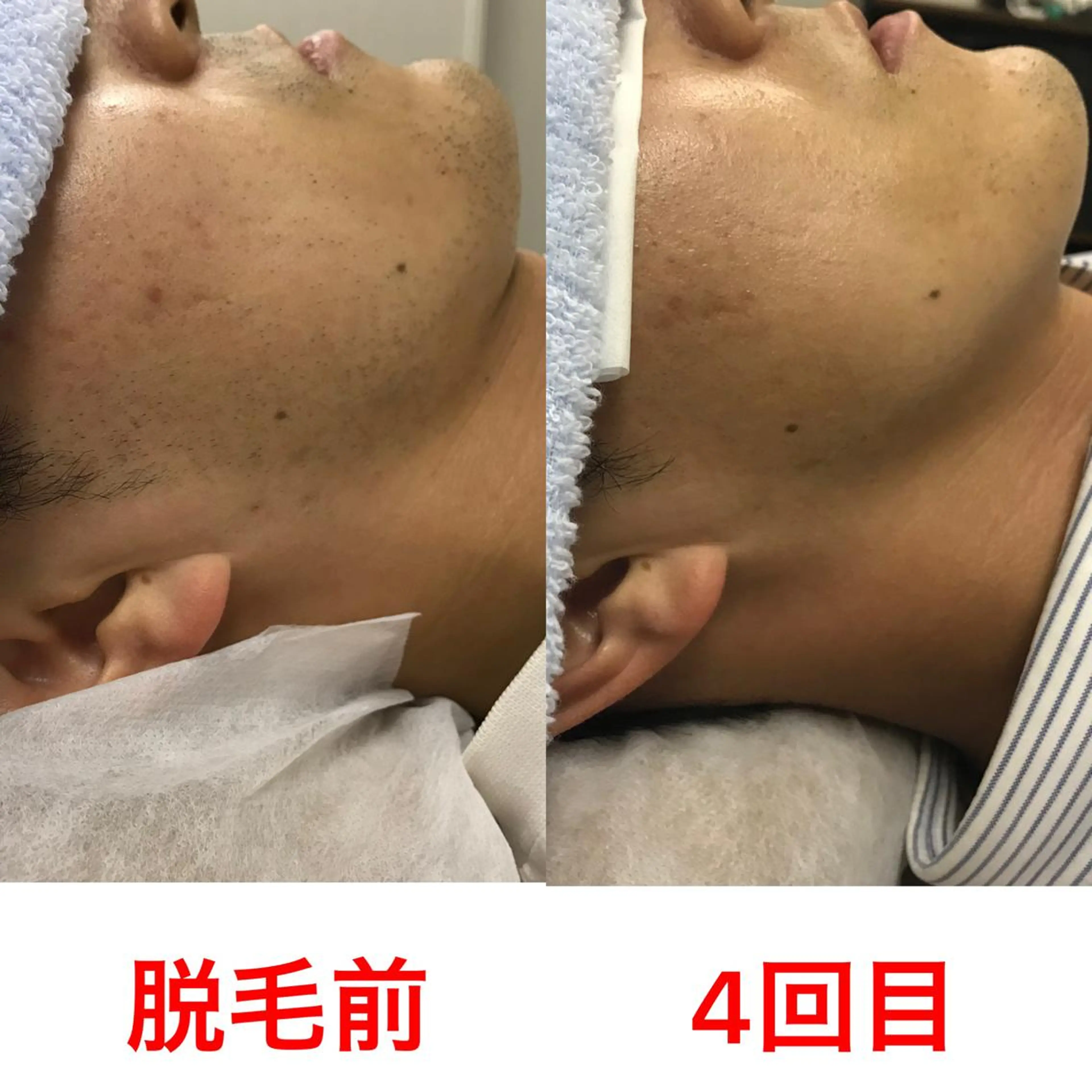 メンズ 脱毛 Beauty K's【ビューティーケイズ】所属・メンズ脱毛サロン ／金山昌弘のエステ・リラクイメージ