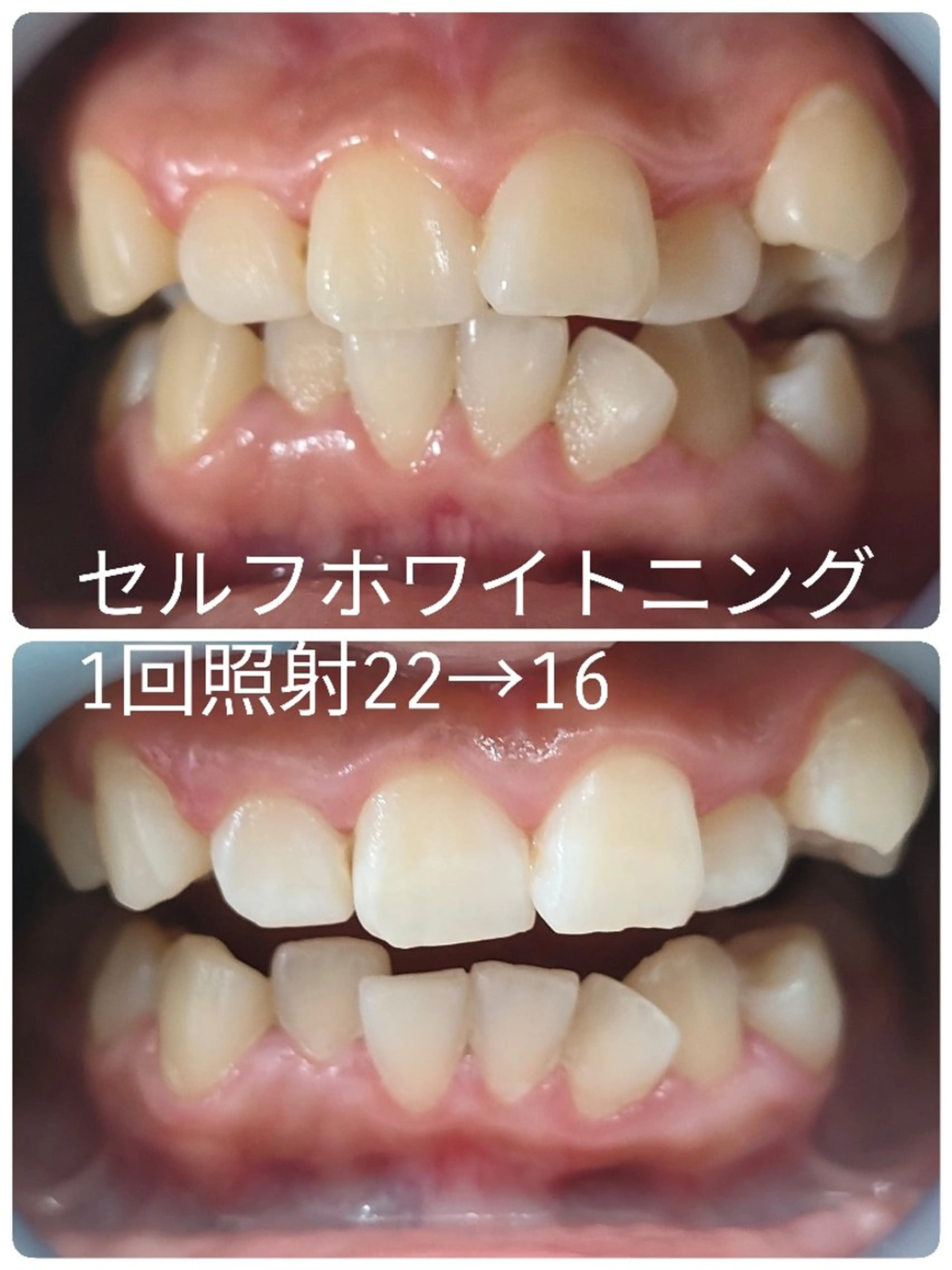 ほわいと あざぶのマツエク・マツパデザイン