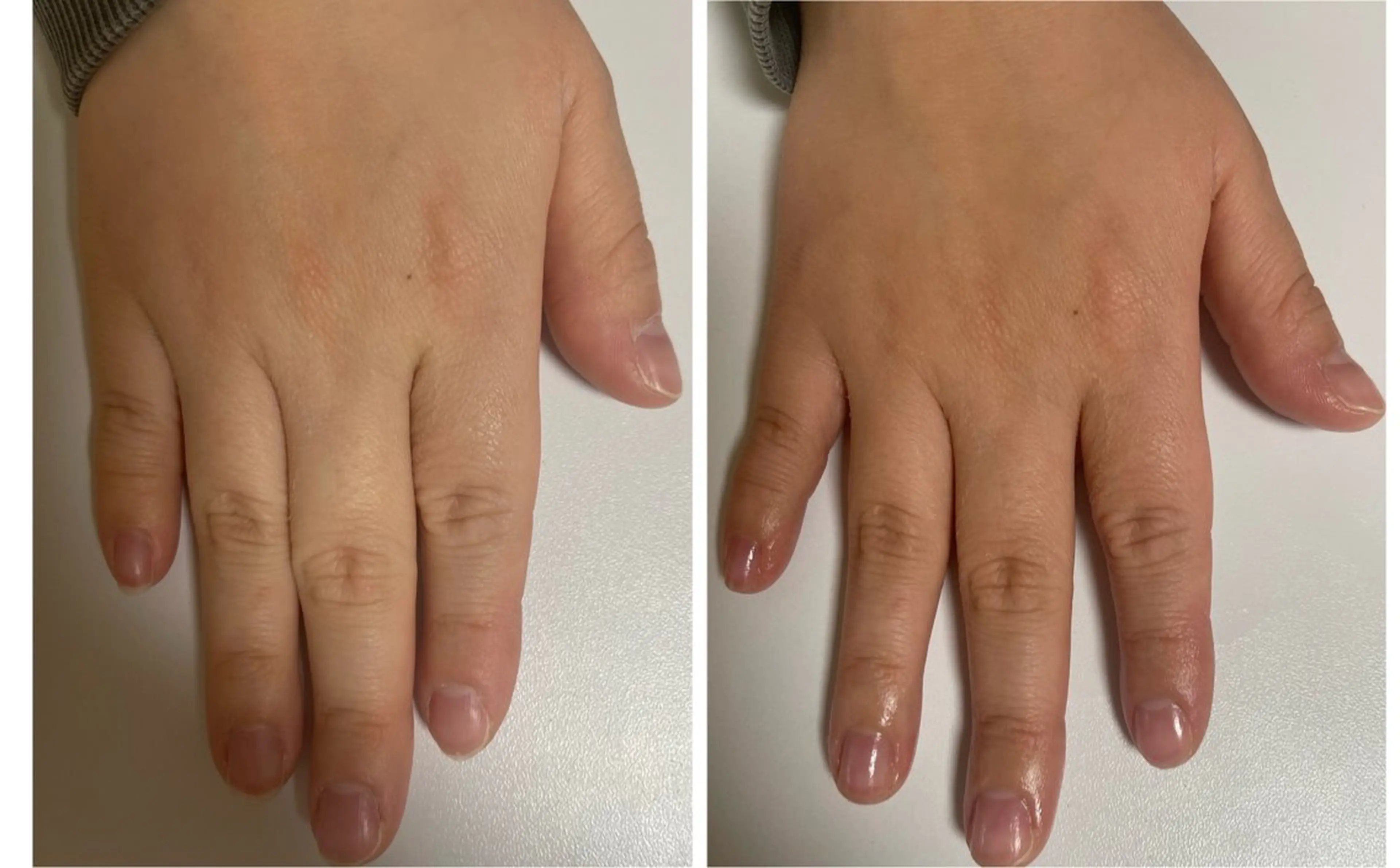 ネイル 🔰 新米ネイリストのネイルデザイン