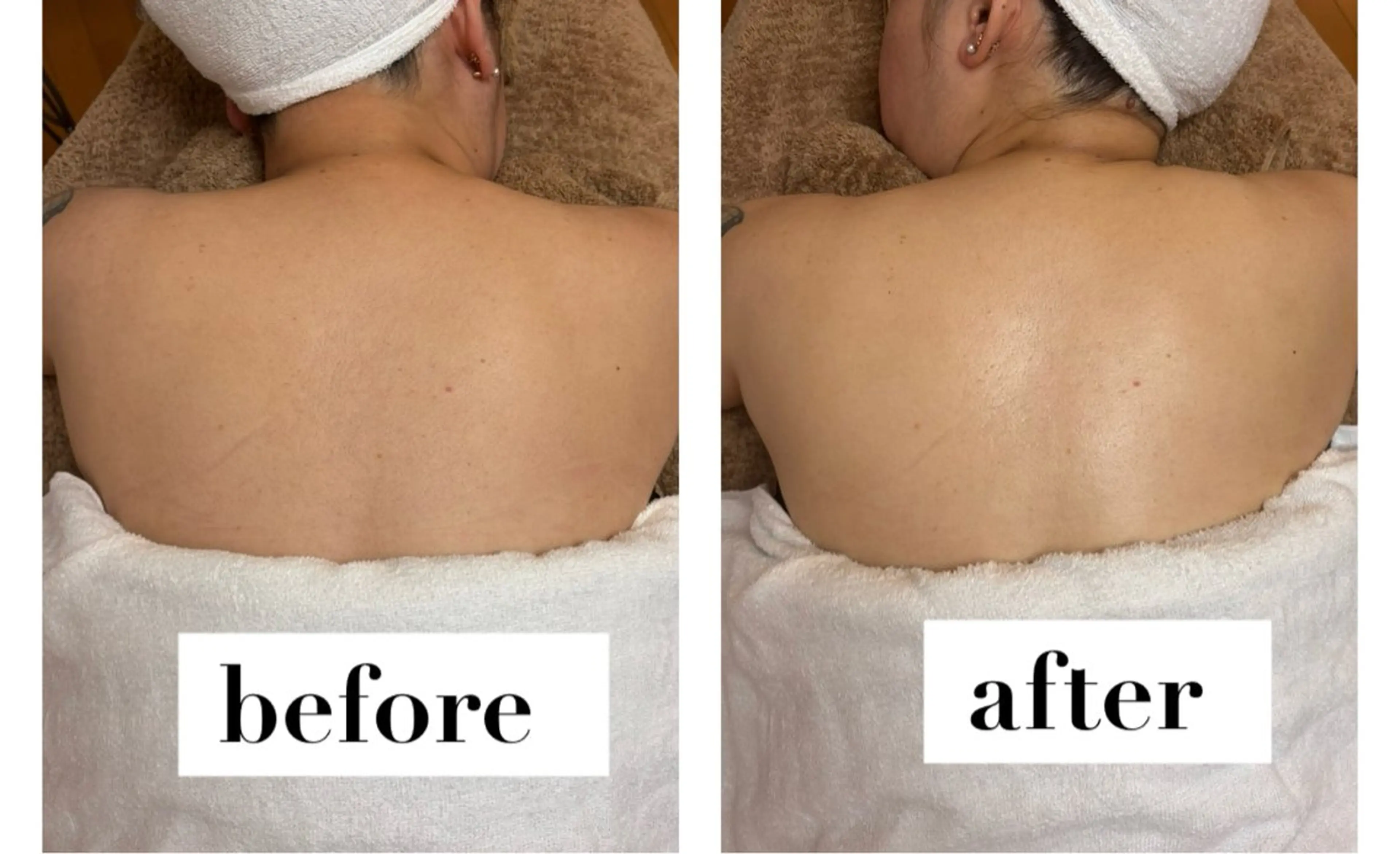 フェイシャルデコルテケア(フェイシャルエステ)+アロマオイルマッサージの写真