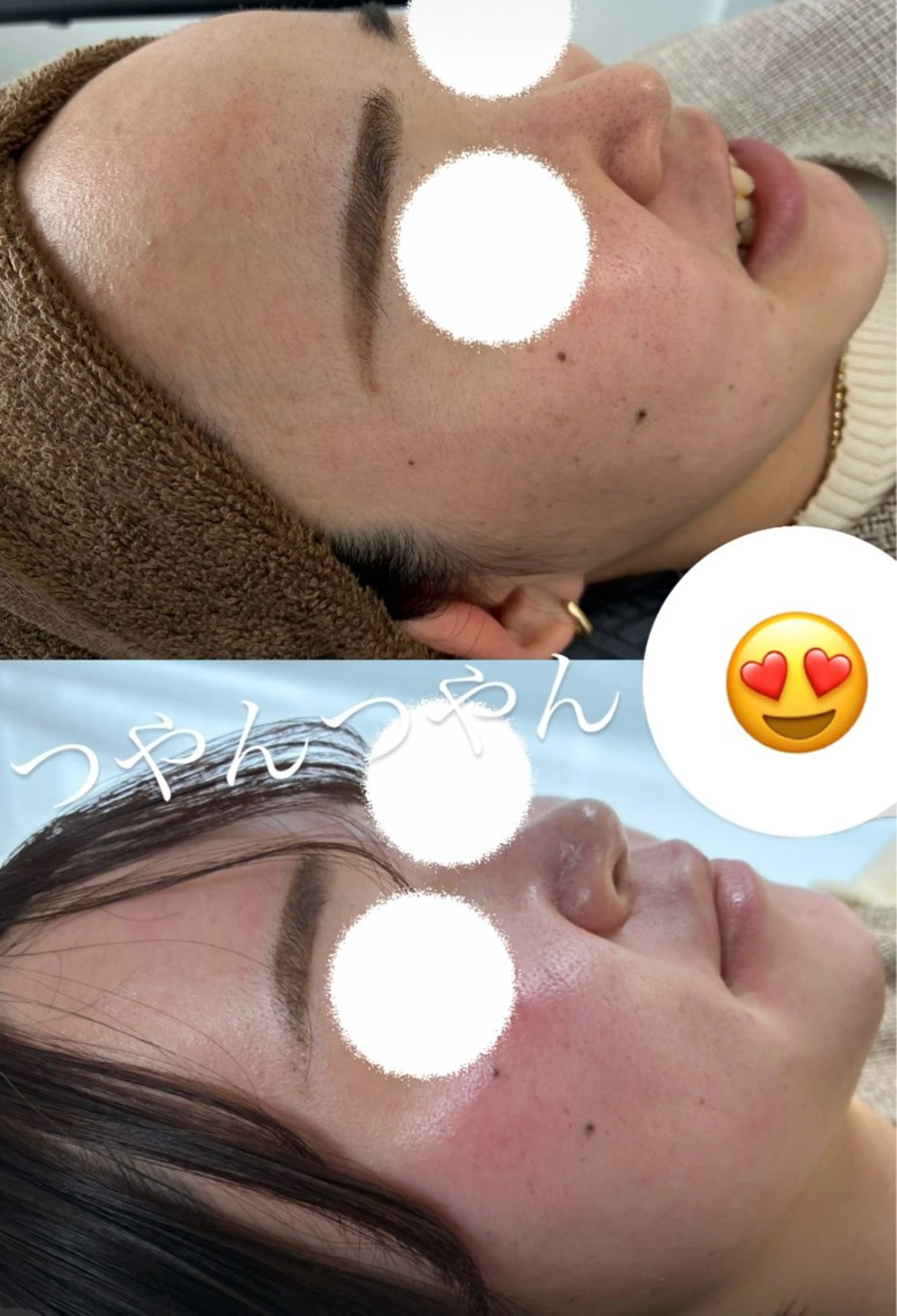 【眉毛デザインWax &MinMinWax全顔】の写真