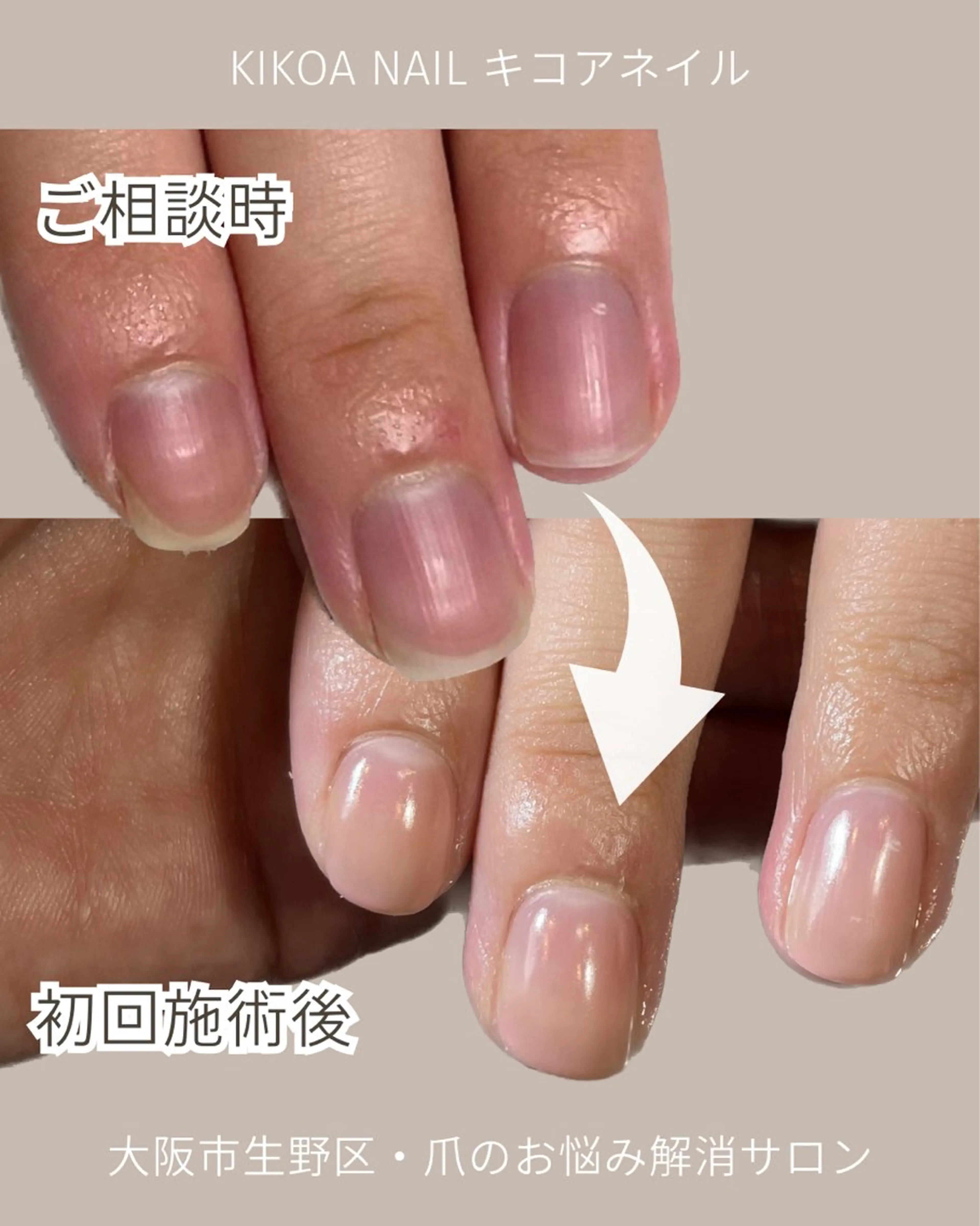 ネイル KIKOA NAIL キコアネイルのネイルデザイン