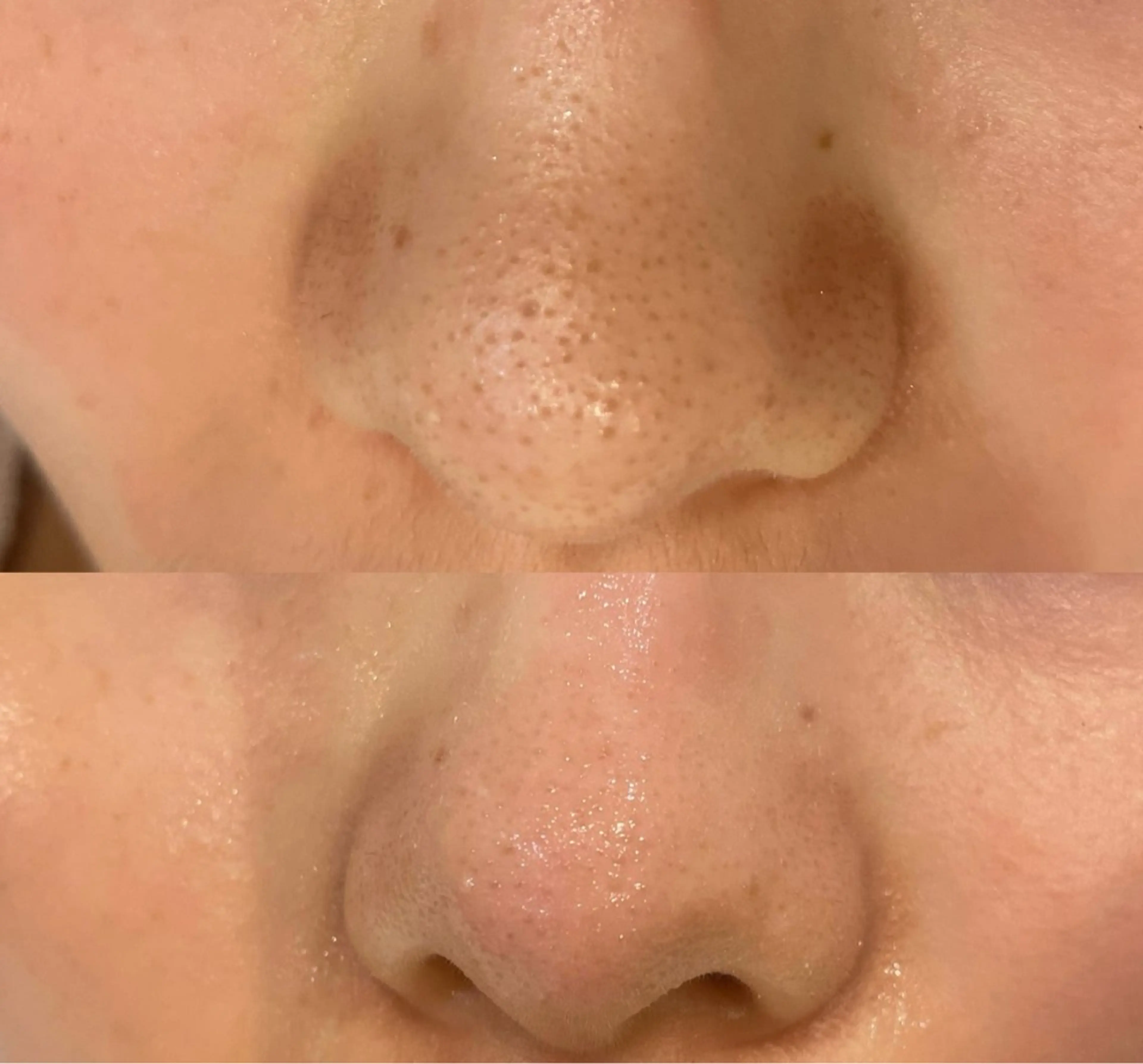 DeI'm   名古屋栄所属・小林 玲菜のエステ・リラクイメージ