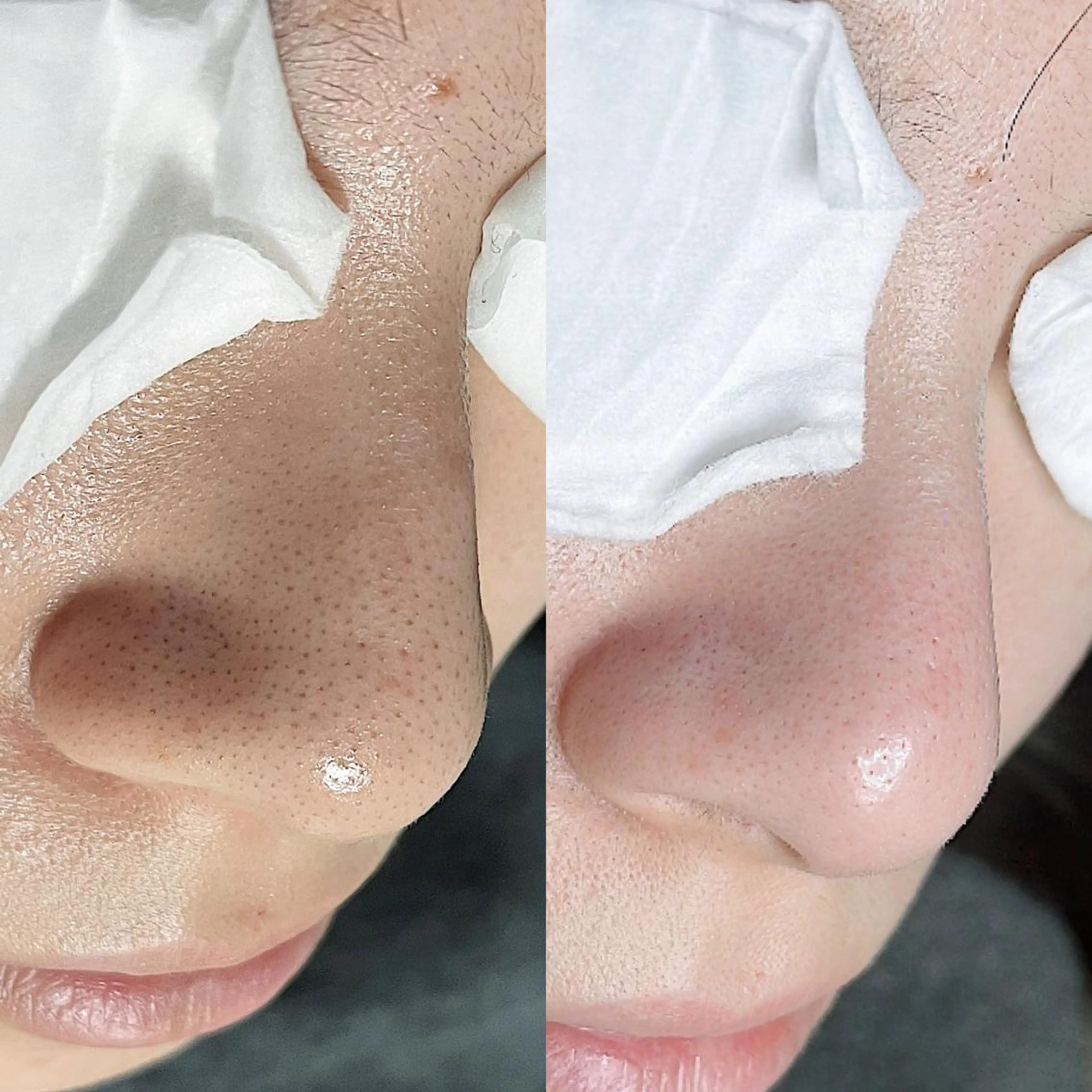 C. Lのマツエク・マツパデザイン