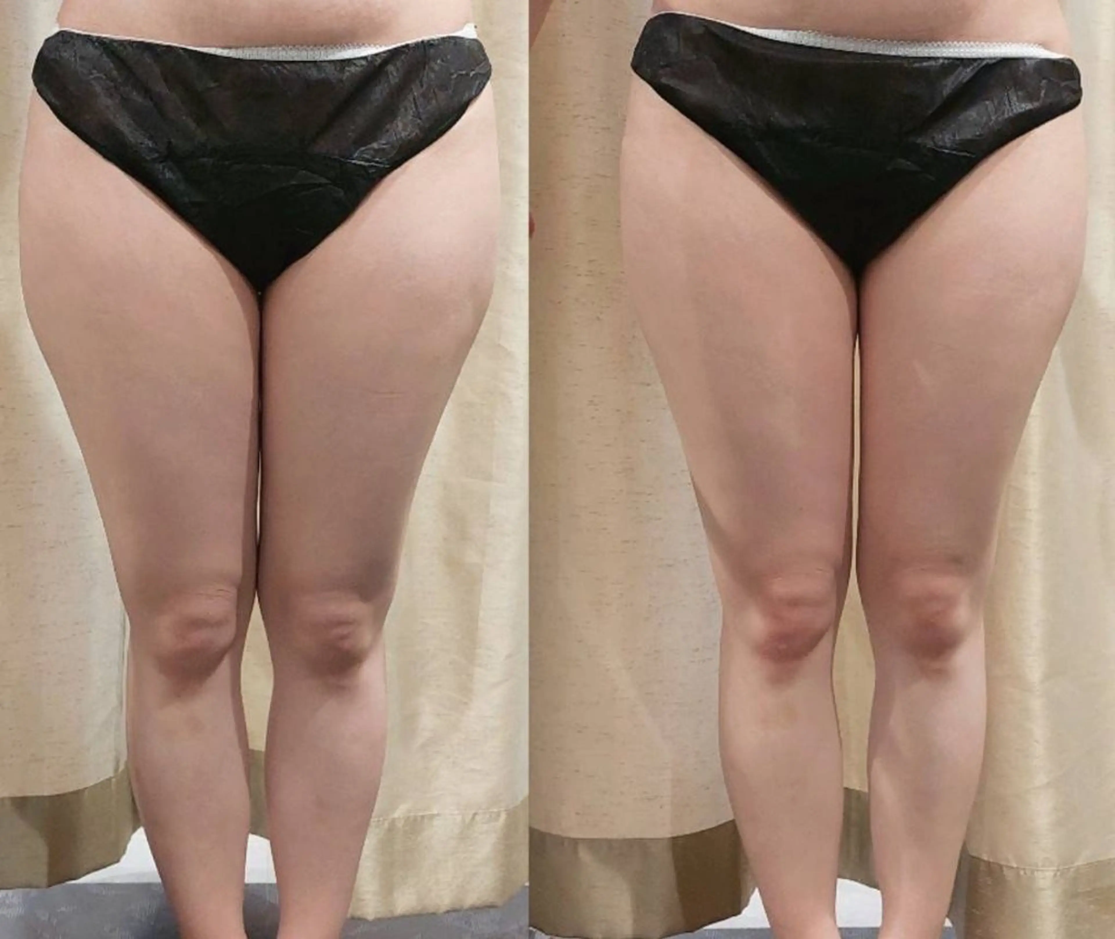 エステ リラク MyFairLady miuのエステ・リラクイメージ