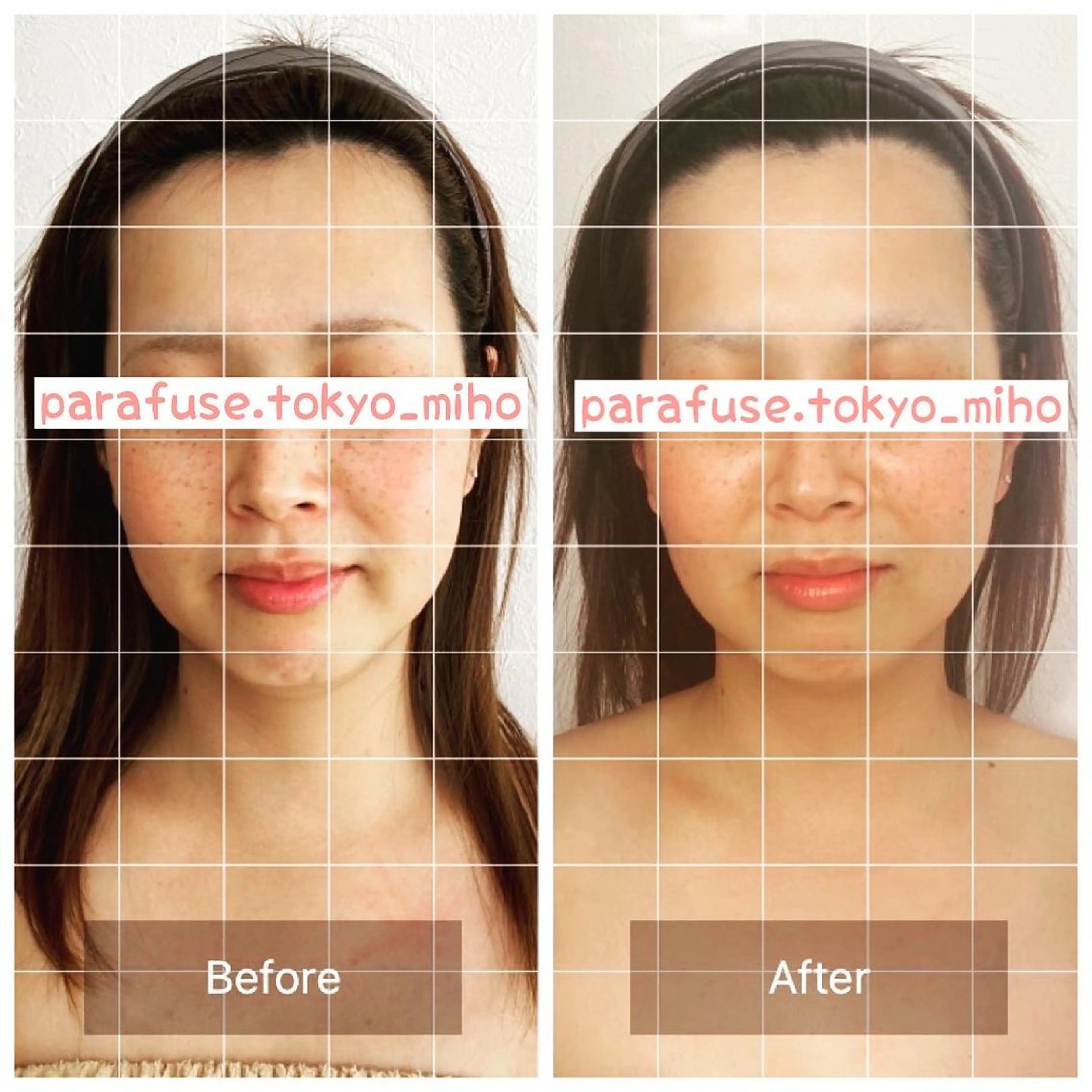 100分🧠脳洗浄®︎/癒しのオイル有り施術 頭だけでは有りません✨足から腕まで身体ごと緩める施術です。の写真