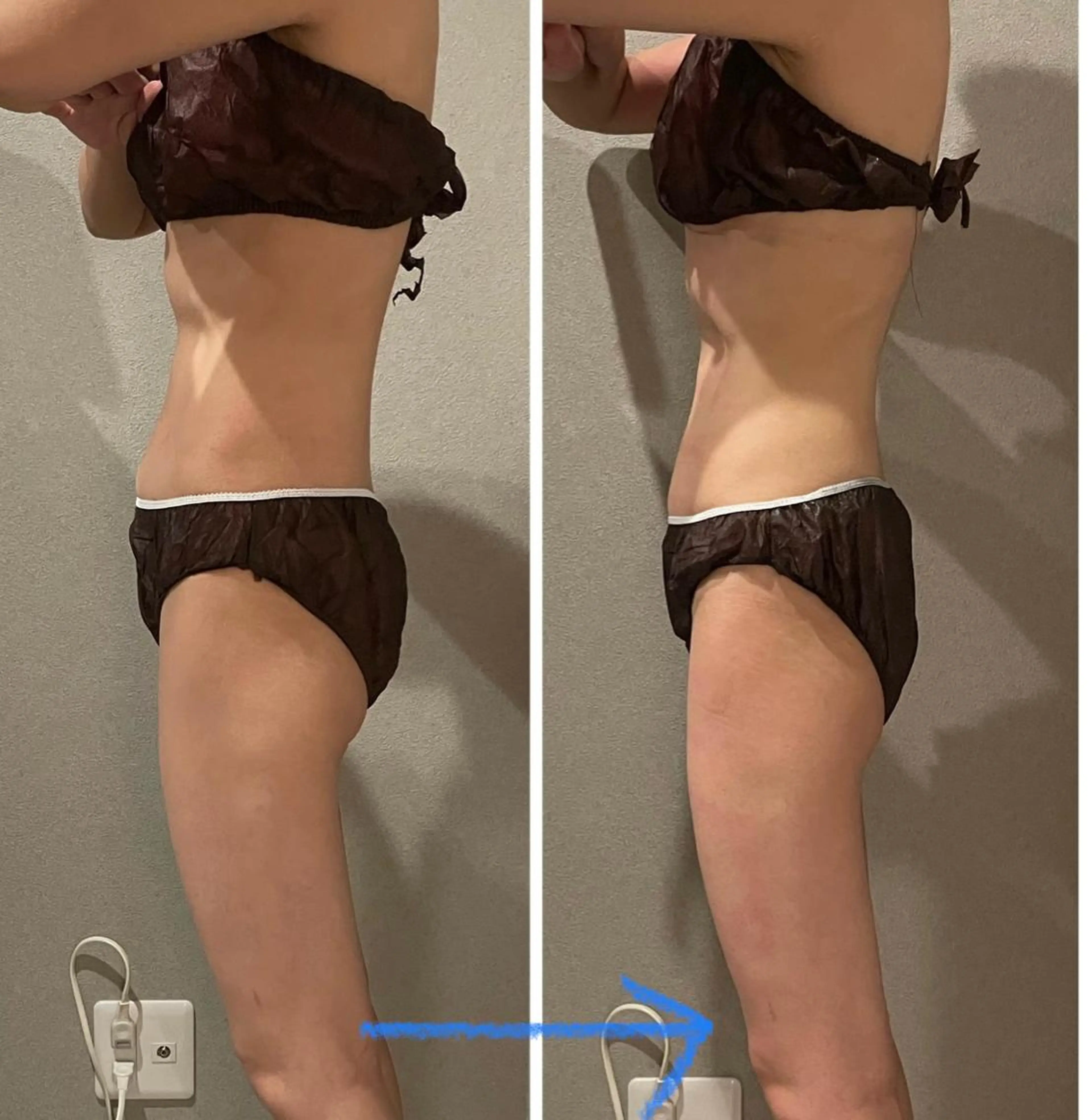 エステ エステ／ネイル/脱毛 R.Msalonのネイルデザイン