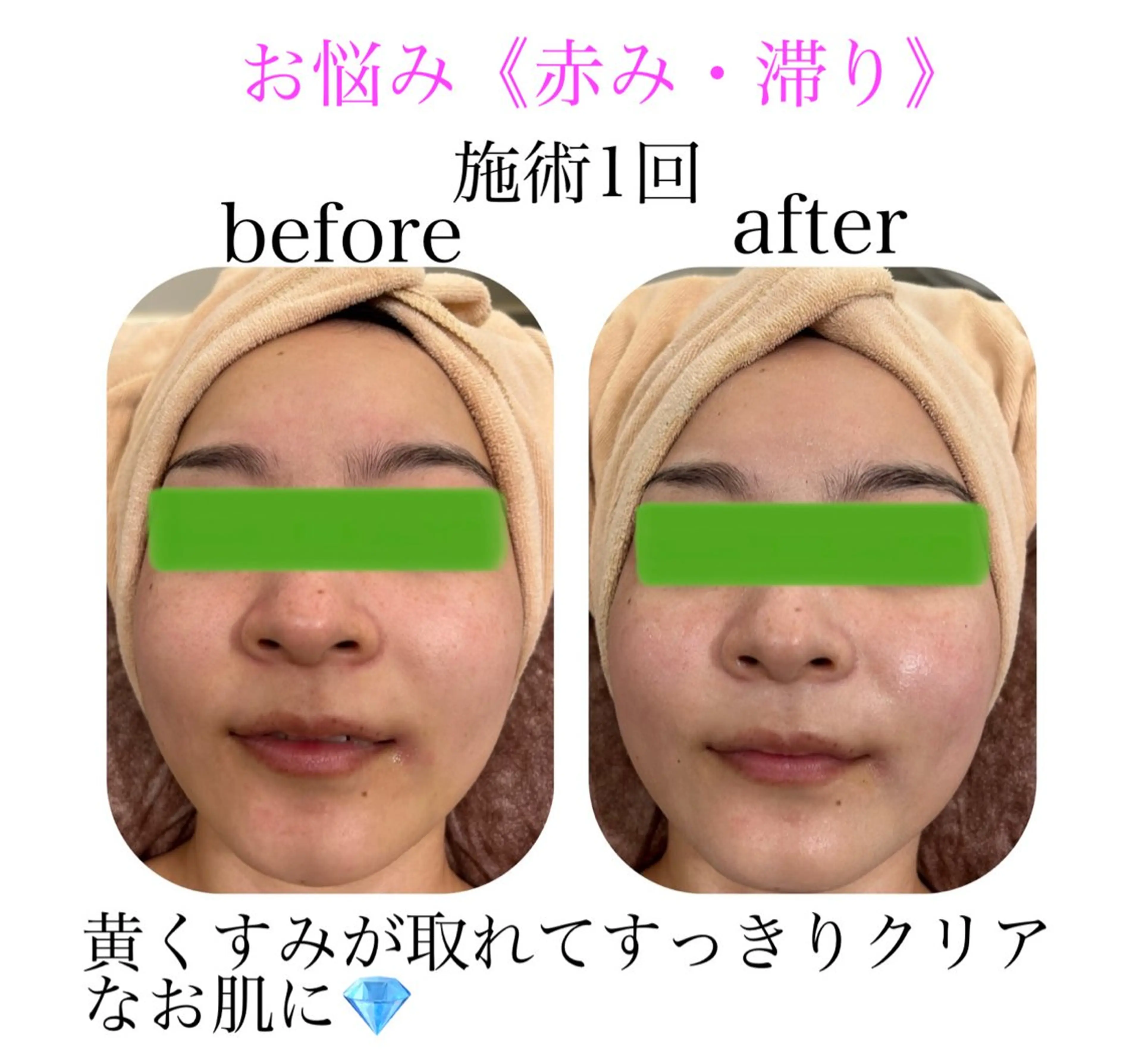 小顔&美肌品川店 Masqueradeのエステ・リラクイメージ