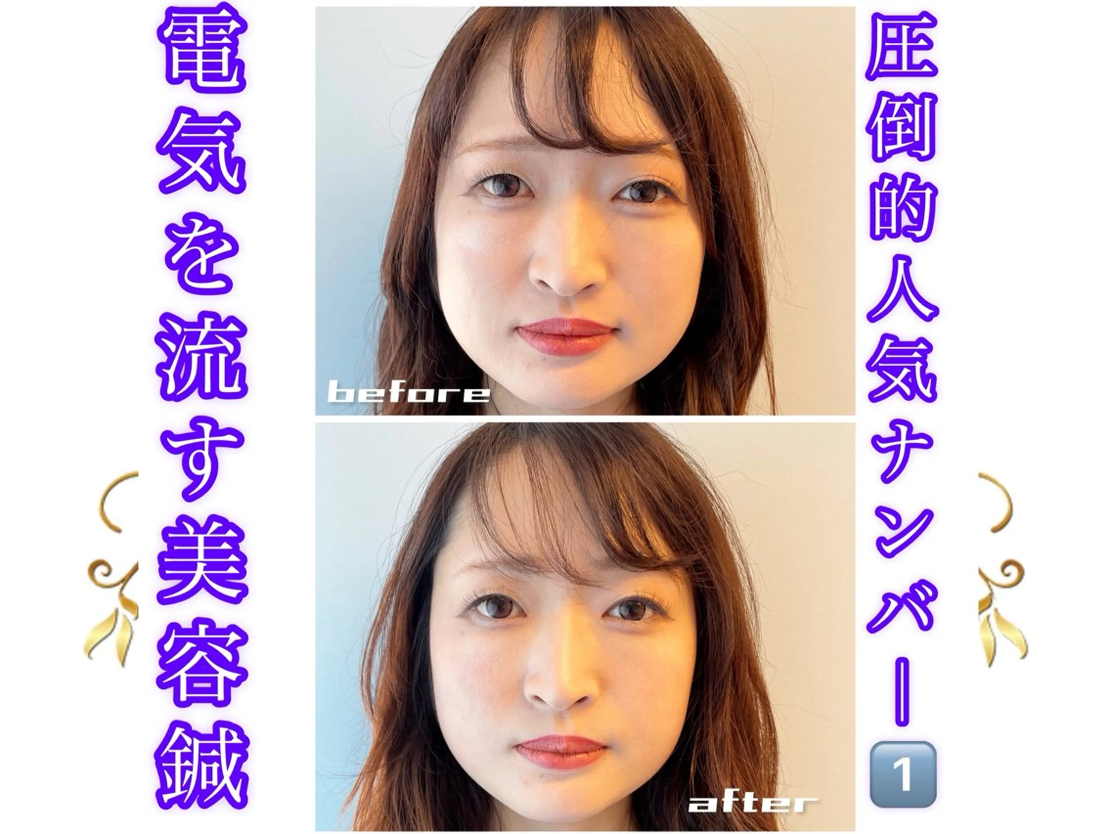 エステ リラク 小顔美容鍼専門サロン 渋谷YZのエステ・リラクイメージ