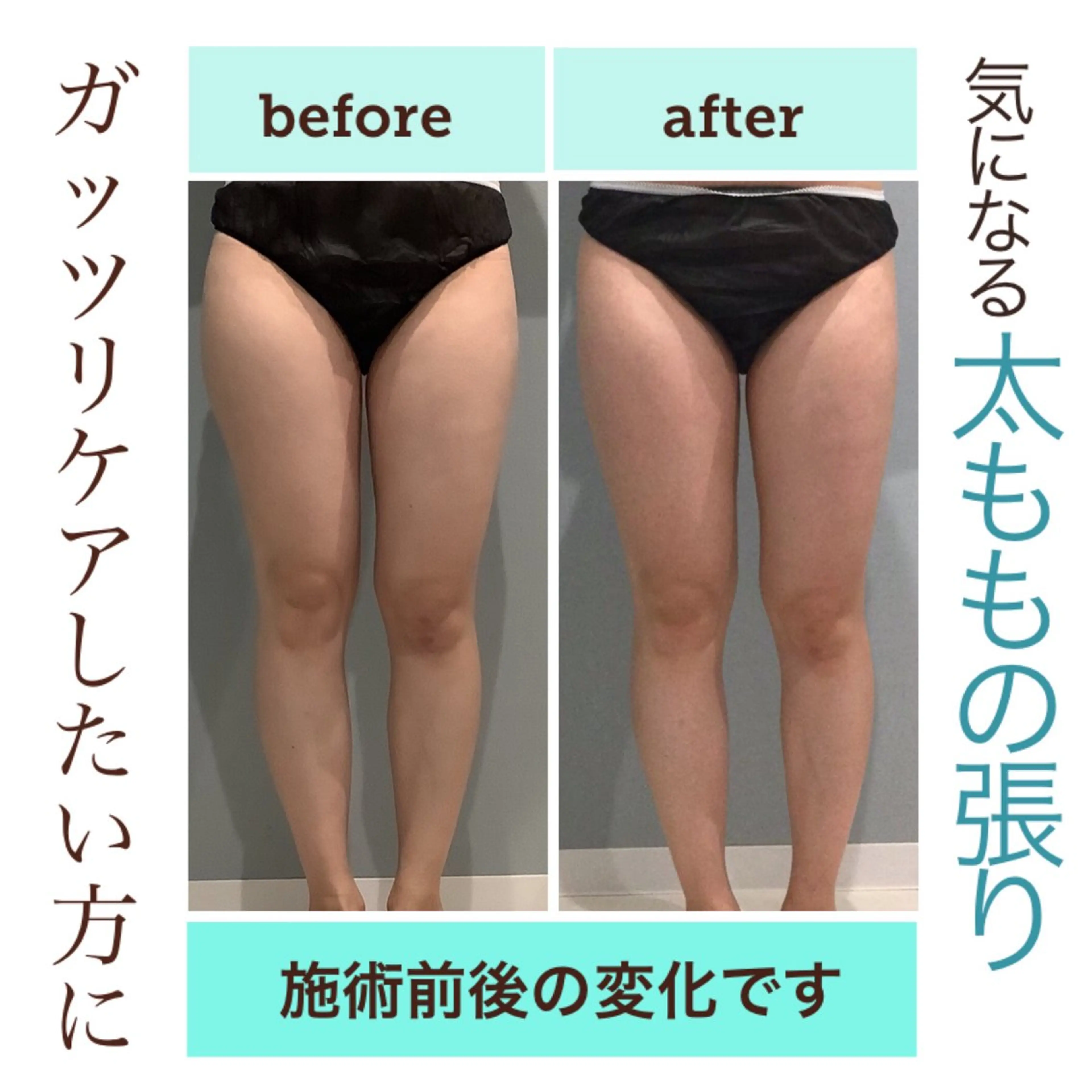 エステ エステサロン JURISのエステ・リラクイメージ