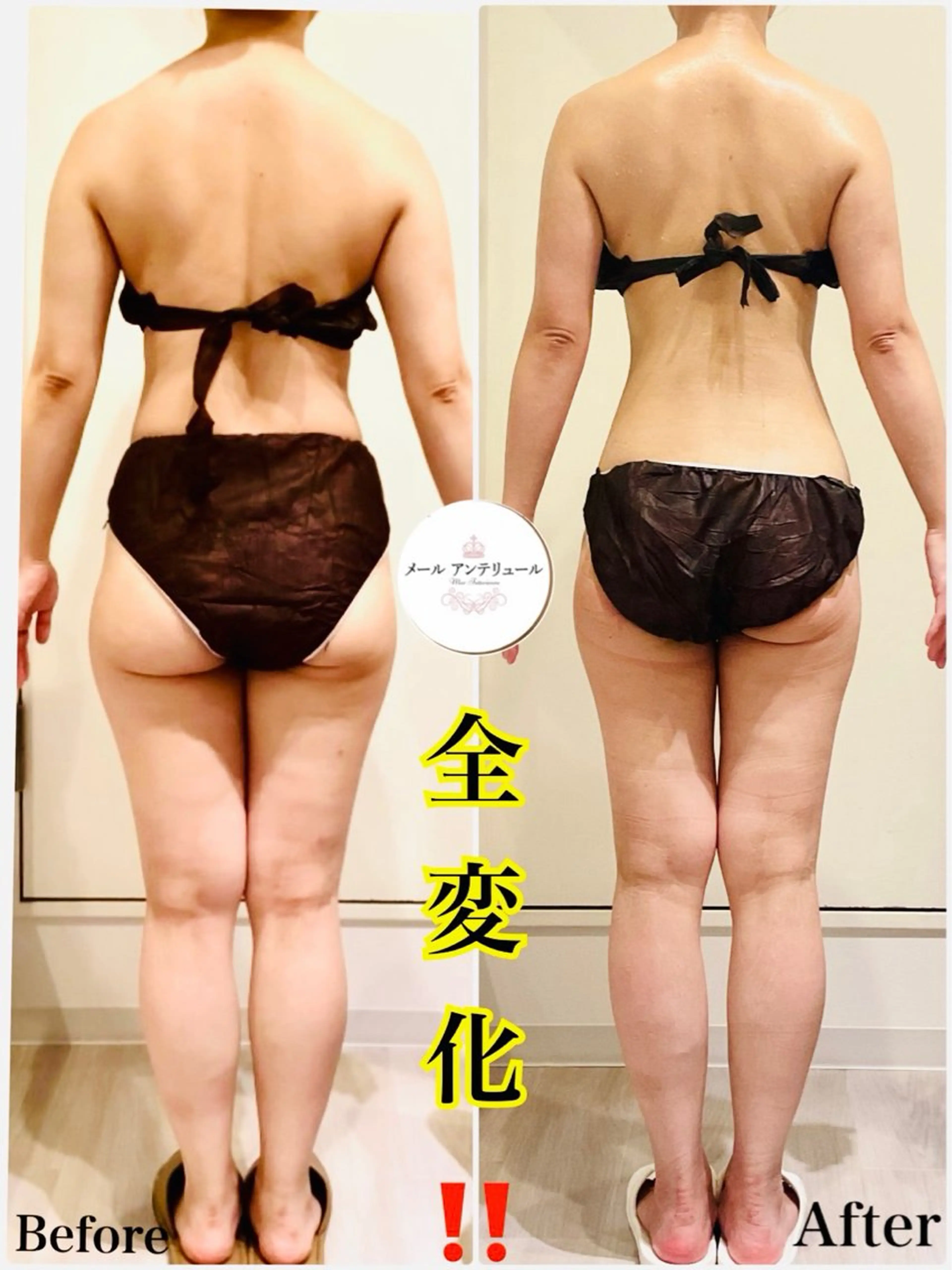 メールアンテリュール 佐野のエステ・リラクイメージ