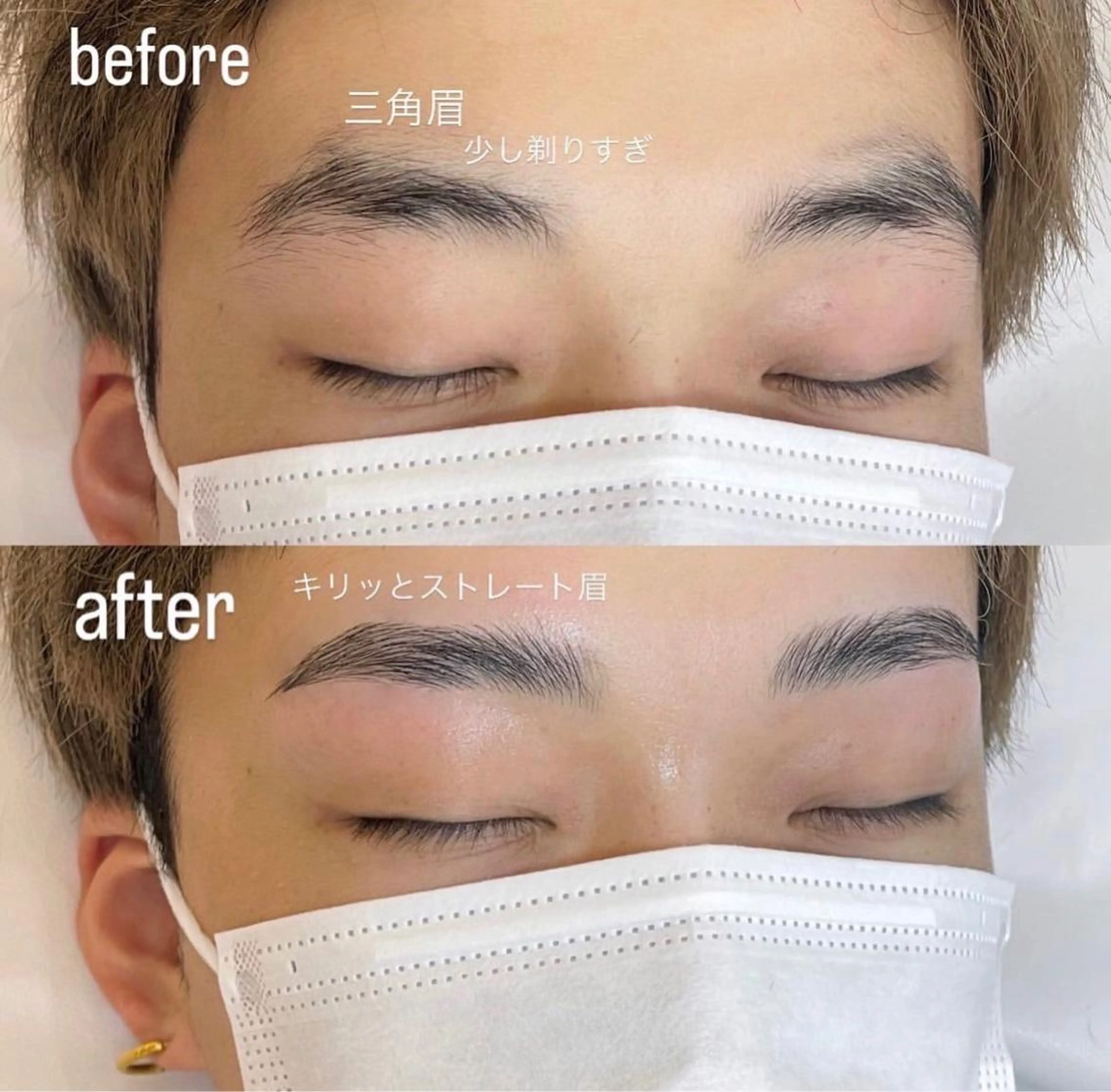 眉ワックス脱毛の写真