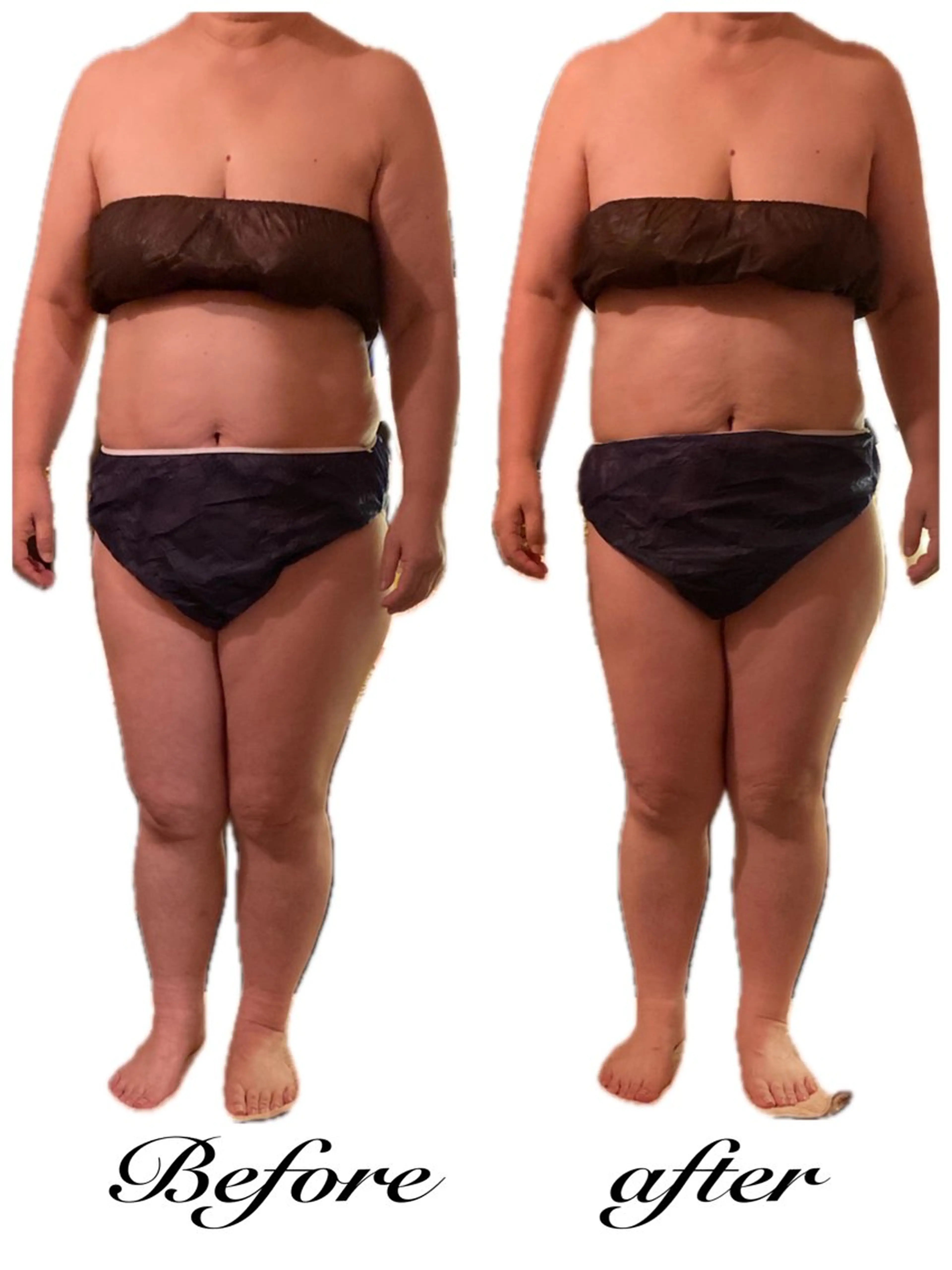 温活痩身サロン LILYのエステ・リラクイメージ