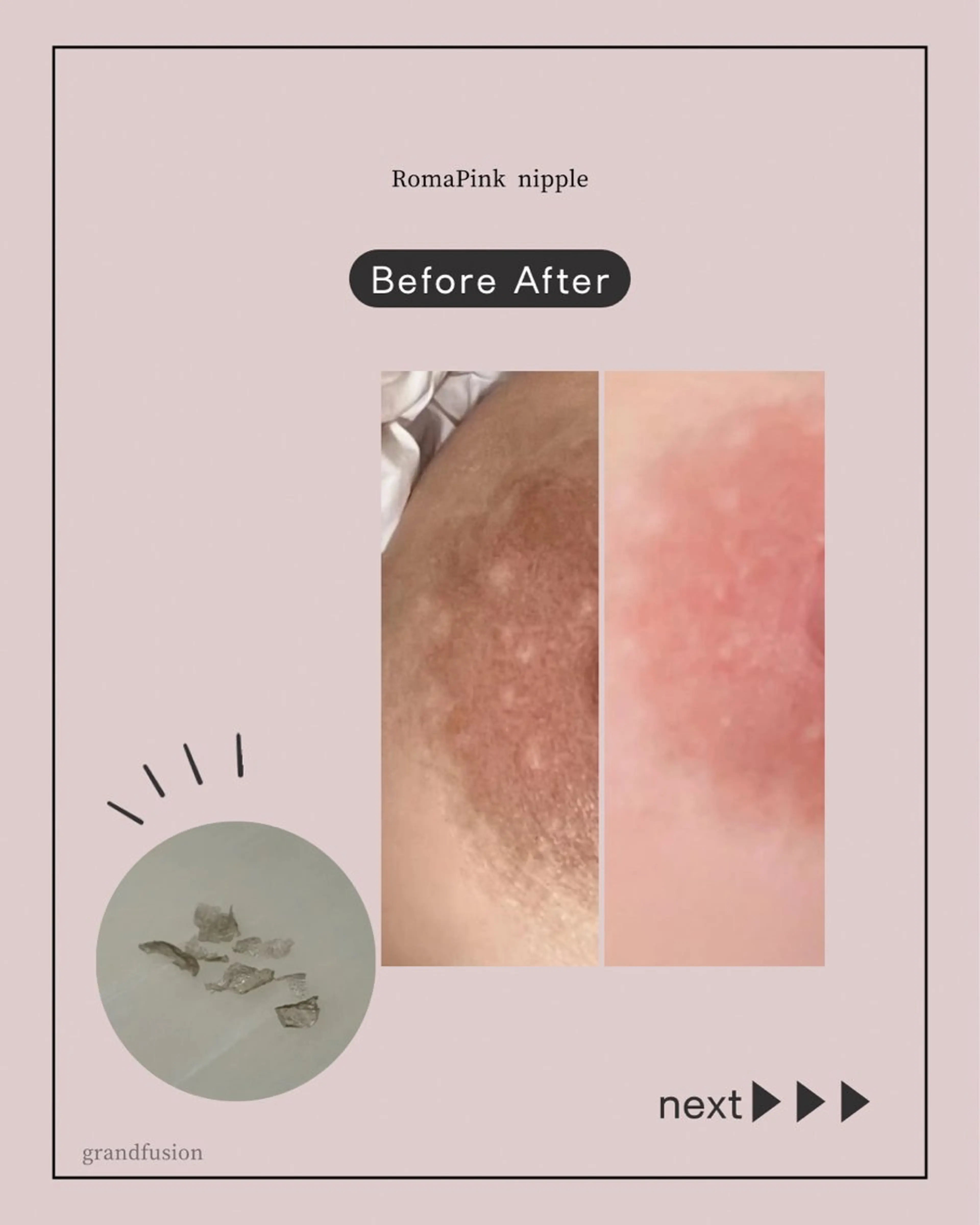 本気で痩せたい方へ 痩身専門サロンのエステ・リラクイメージ