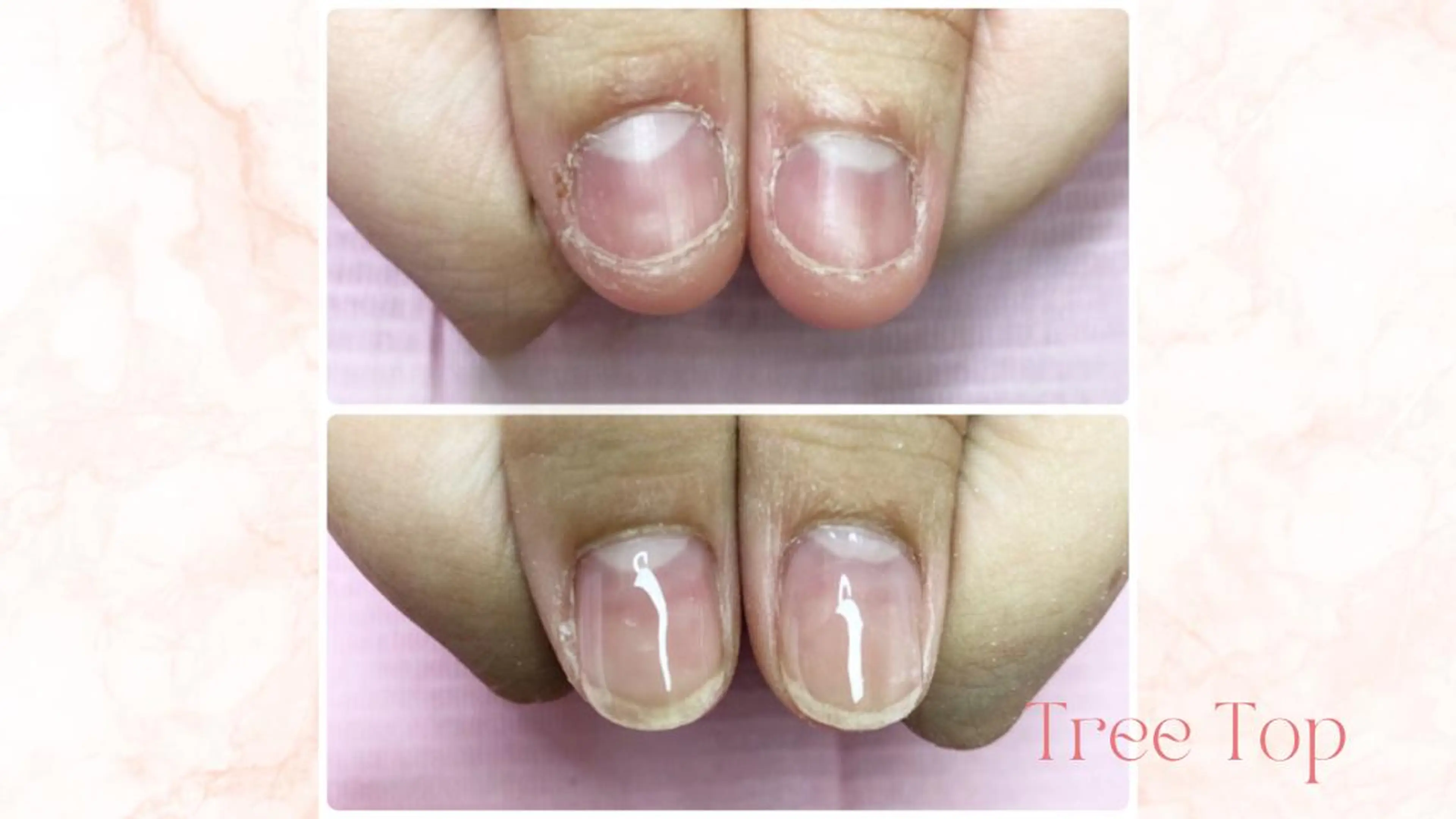 【メンズ】深爪・自爪育(クリアジェル)カラー追加¥1100の写真