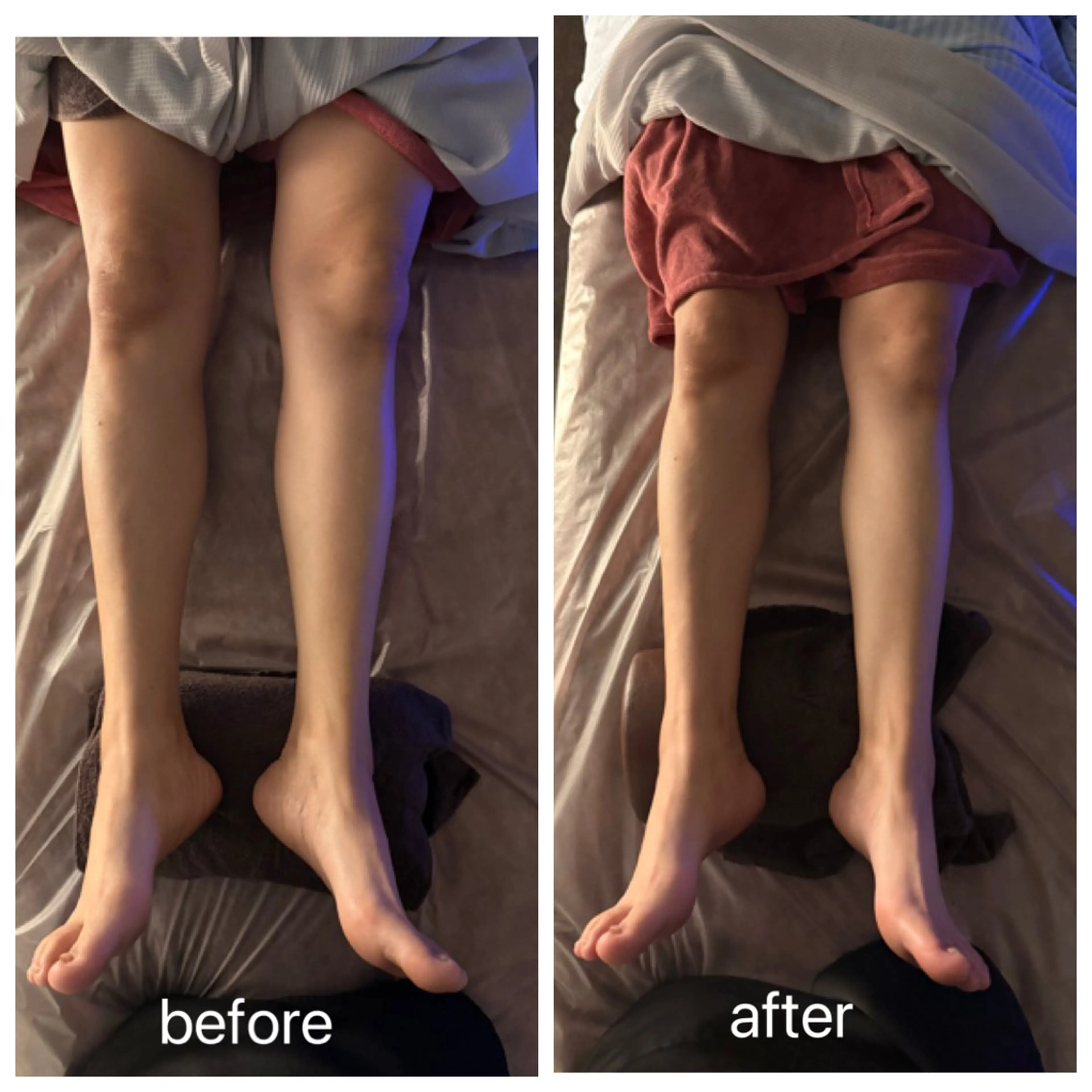 IYASHI所属・IYASHI れなのエステ・リラクイメージ