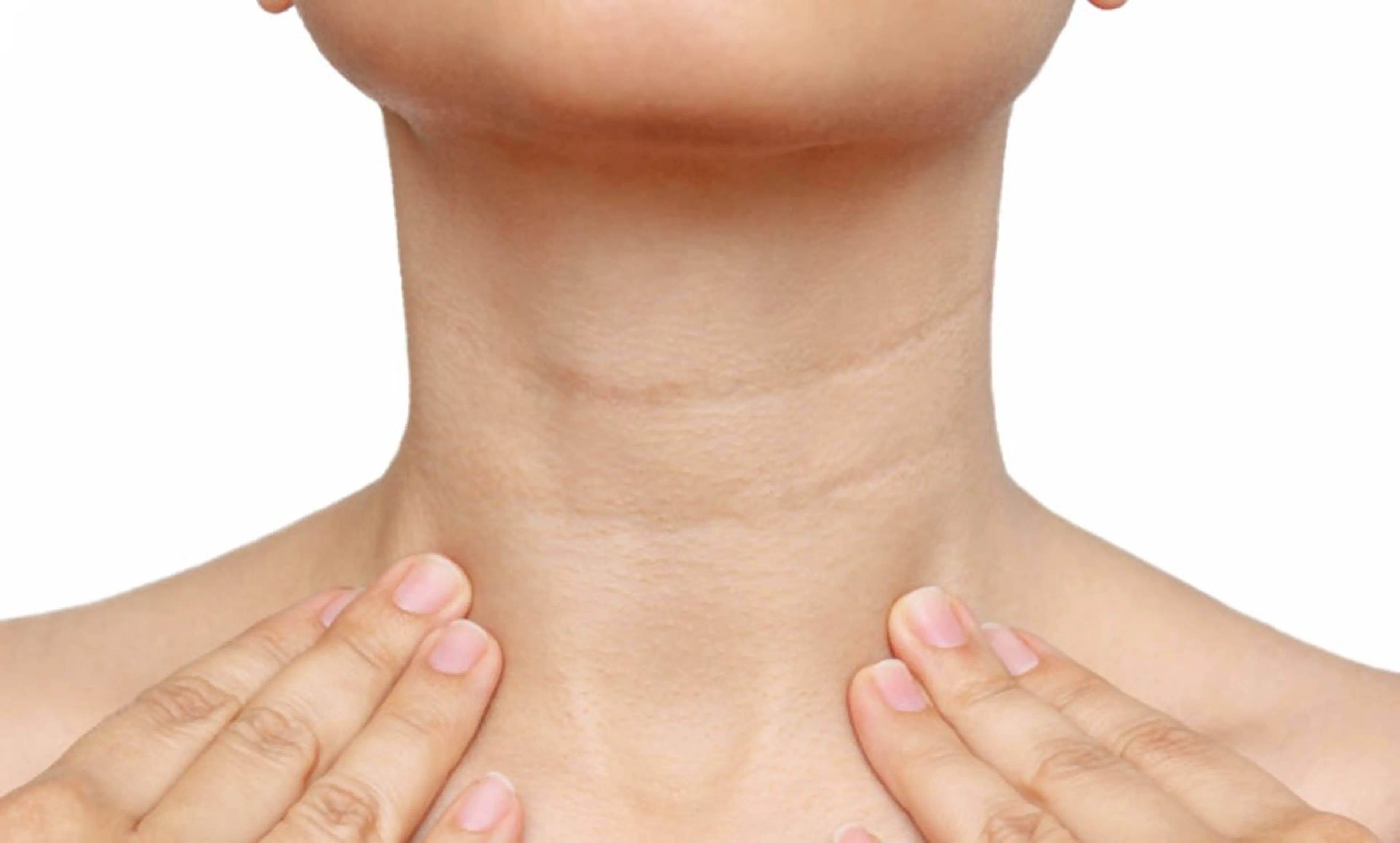 【初回限定】年齢サインが気になる方へ！首元からすっきり印象アップ体験の写真