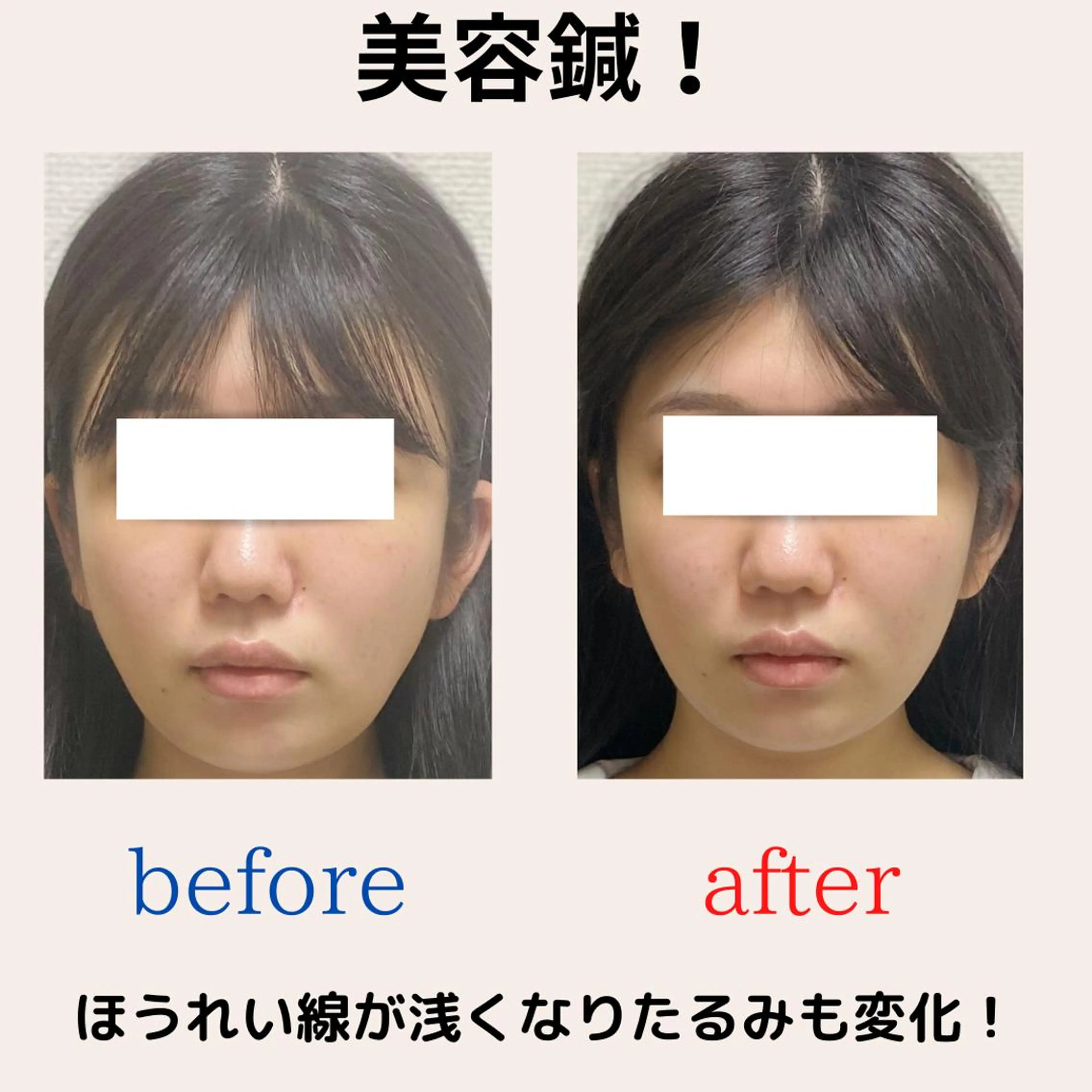 BEAUTY&HEALTH鍼灸院【春日部筋膜整体タケダ整体院】所属・武田 紘輝のエステ・リラクイメージ