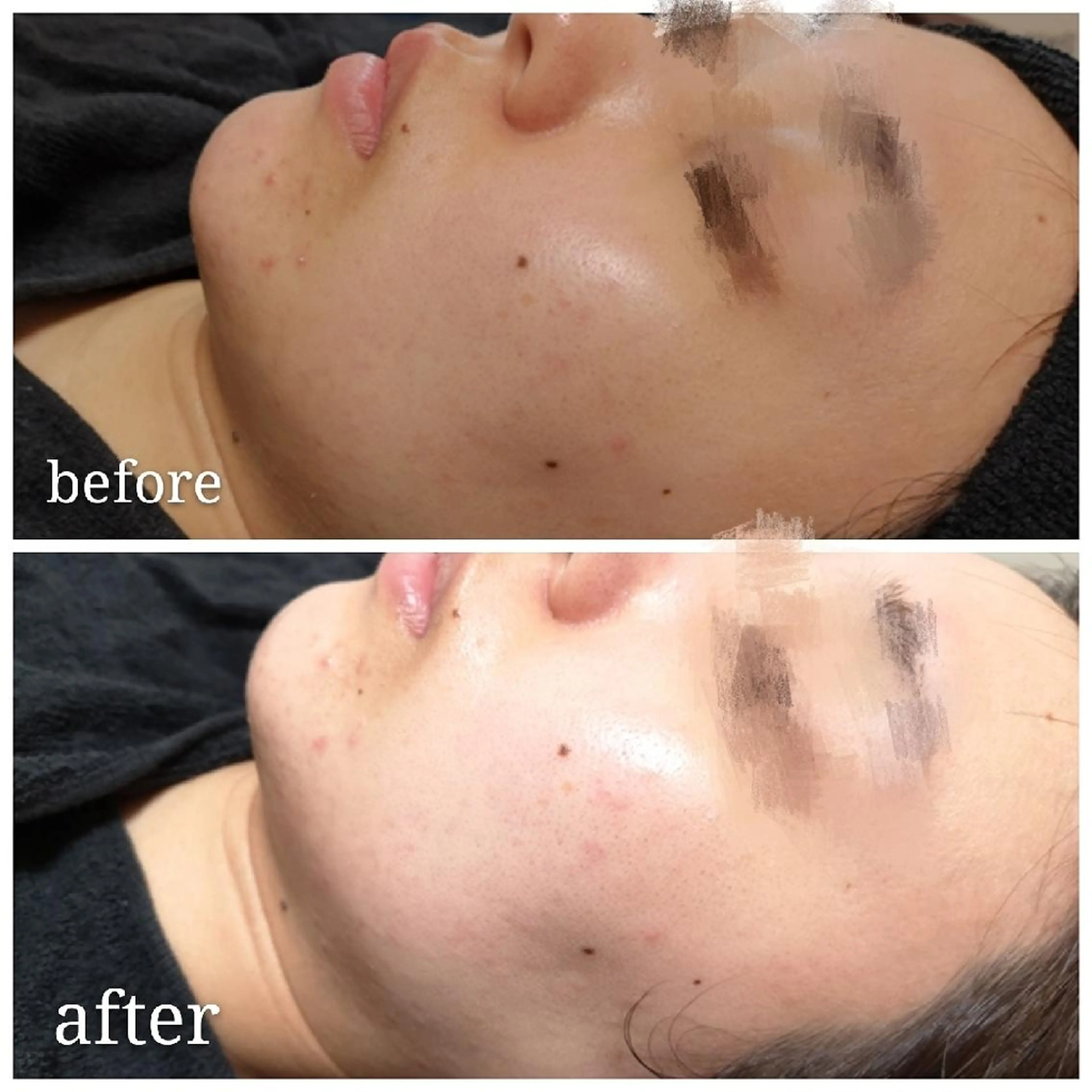 🅖🅤🅩🅔🅛 salonのエステ・リラクイメージ