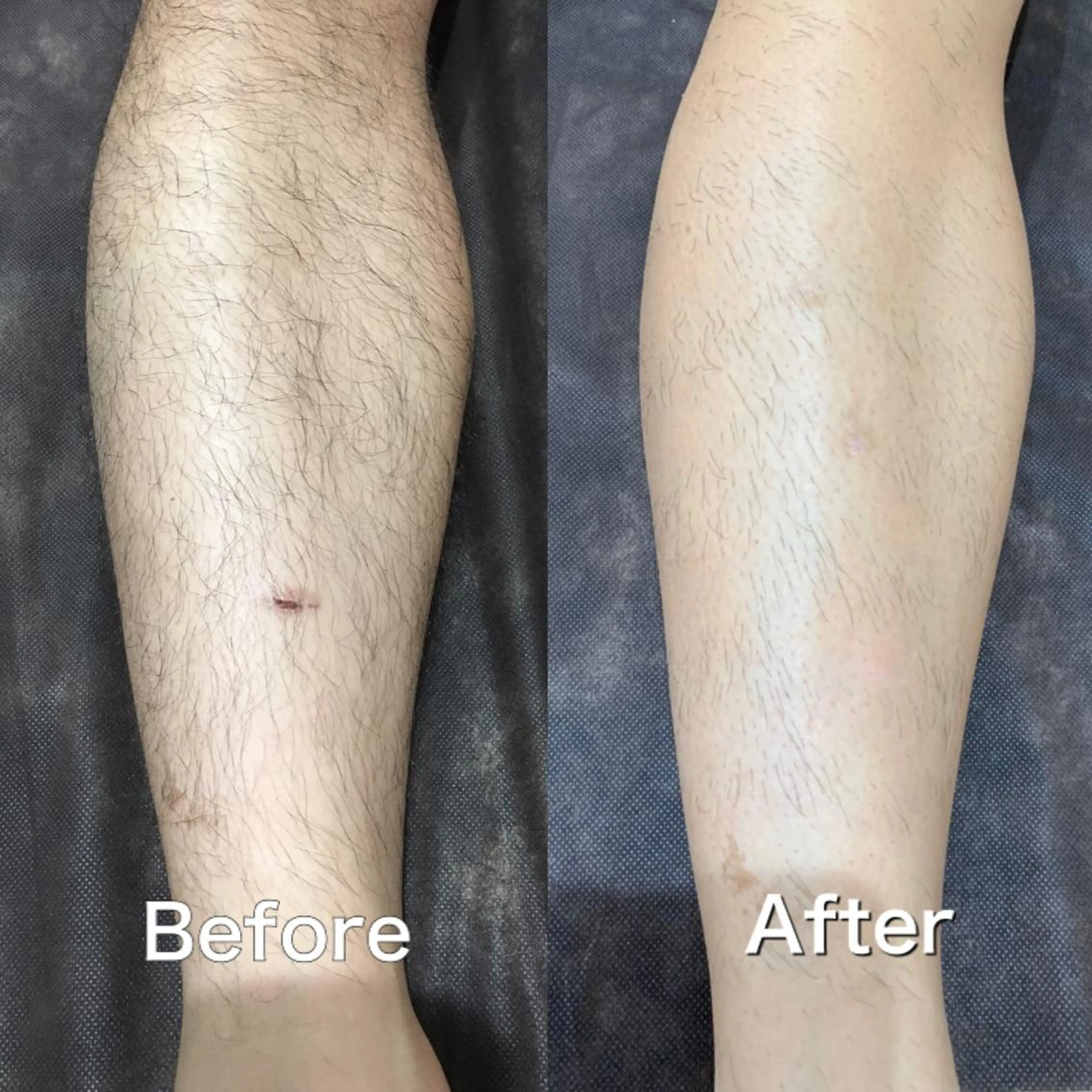 ミディアム カラー パーマ ヘアアレンジ メンズ キッズ ネイル マツエク・マツパ Chloe-クロエ- 脱毛/フェイシャルのエステ・リラクイメージ